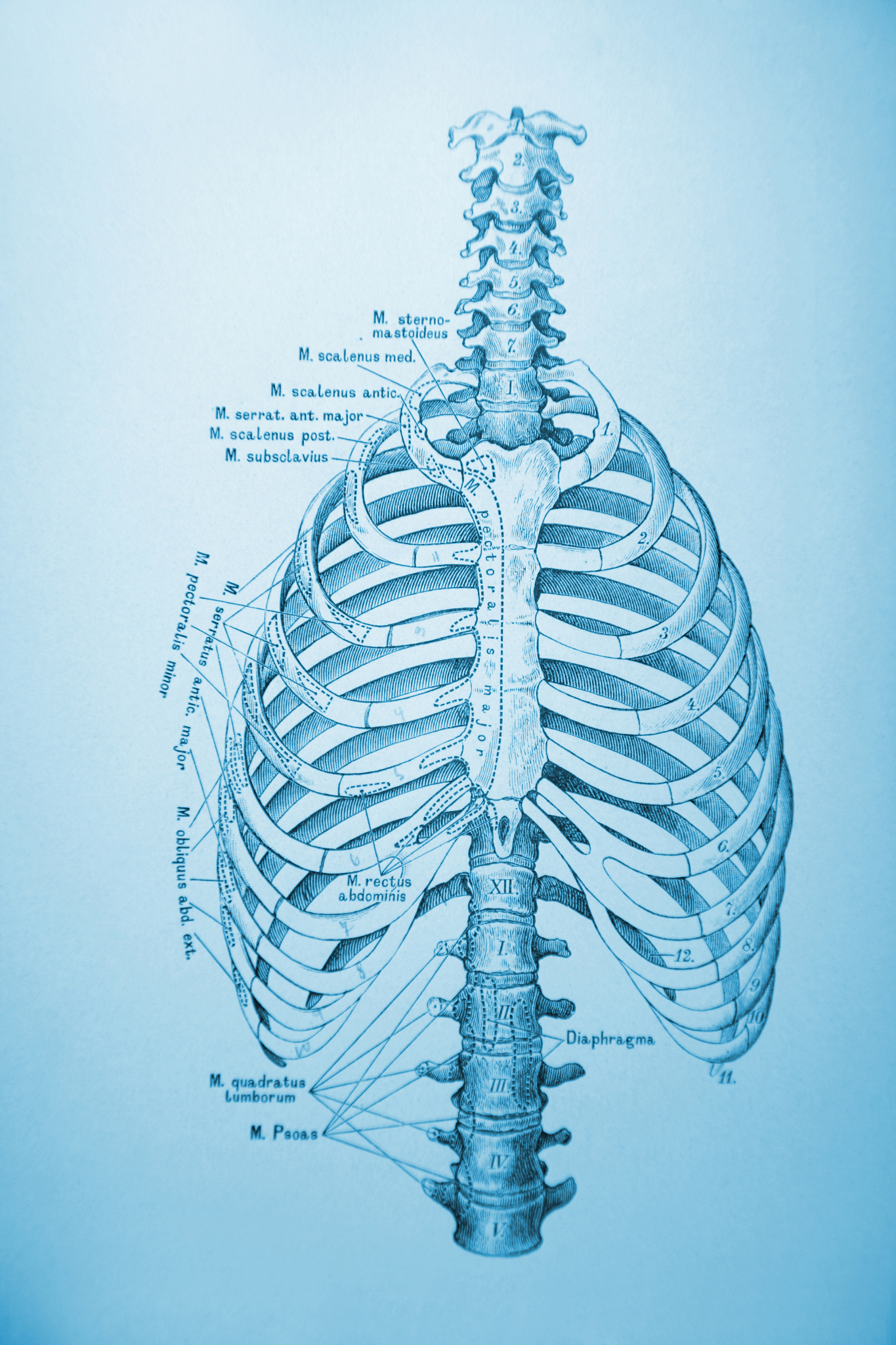 等截面直肋肋端第三类边界条件解析解