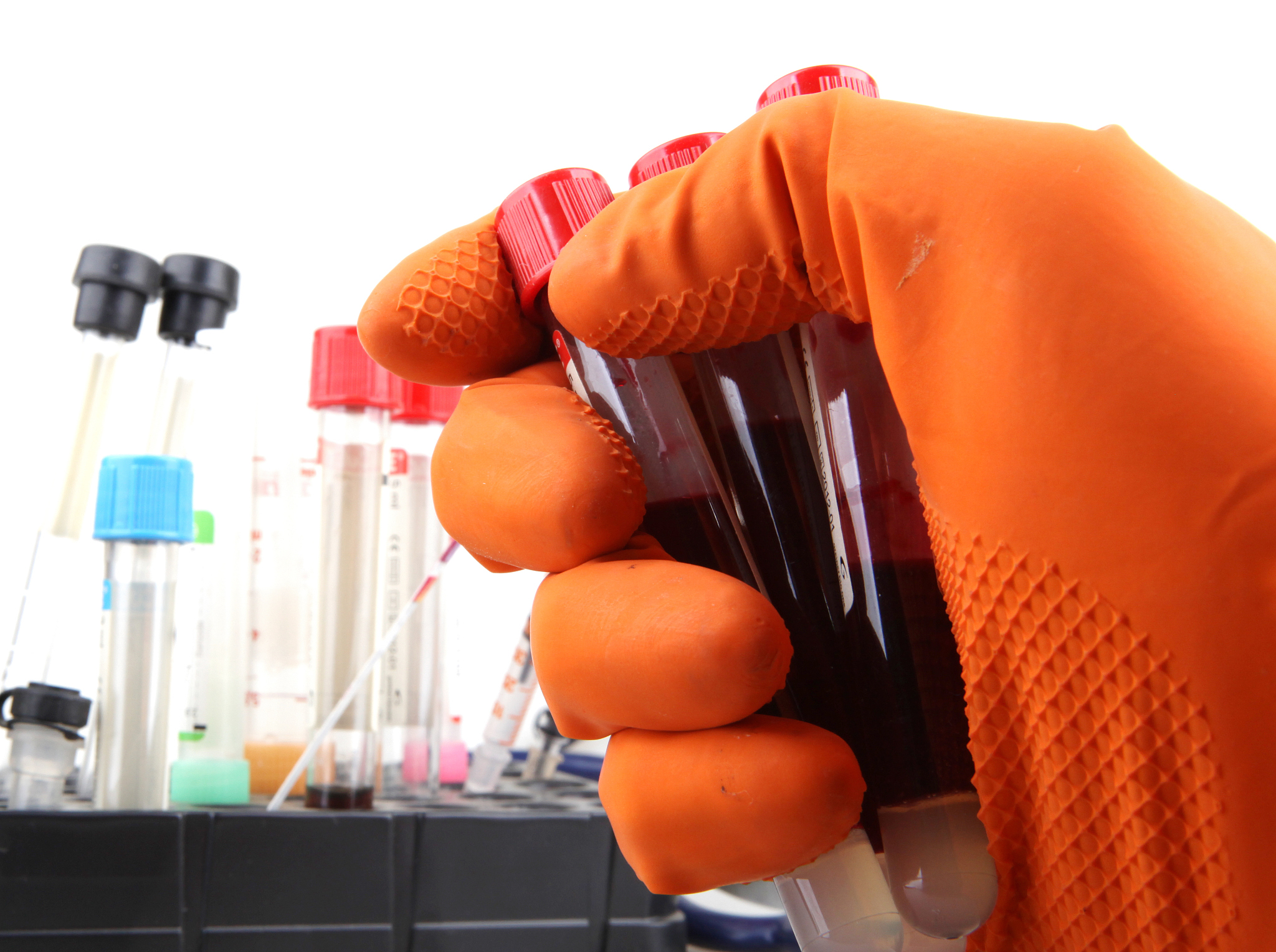 右江民族医学院医学检验专业就业前景及发展方向