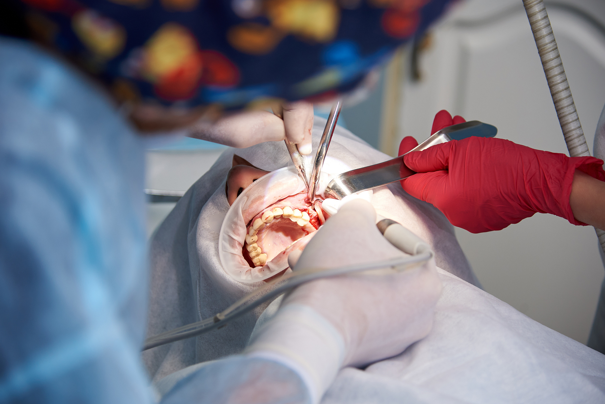 surgery in the dental clinic. sinus lifting operation.