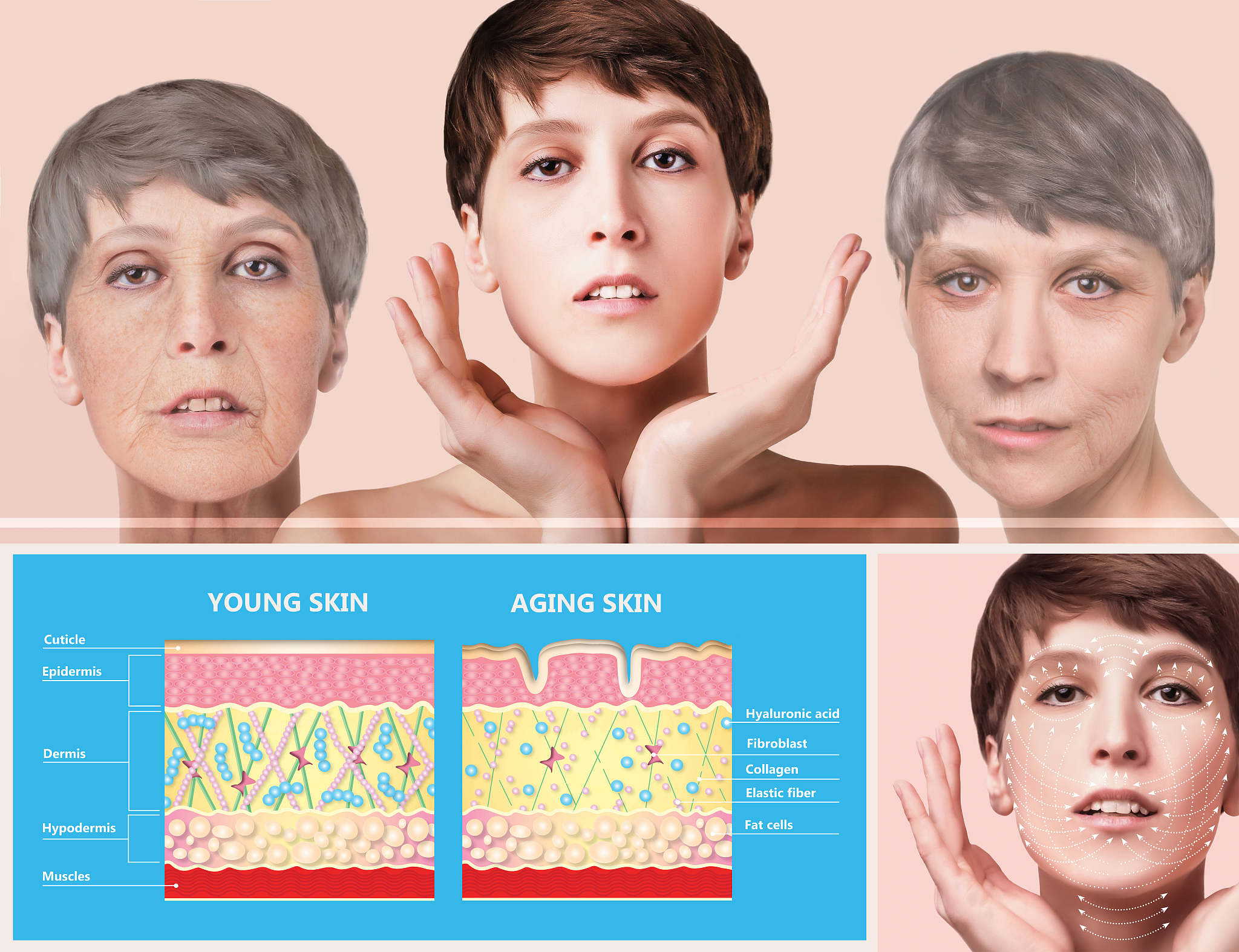 黄金微针：重塑肌肤，焕发年轻光彩