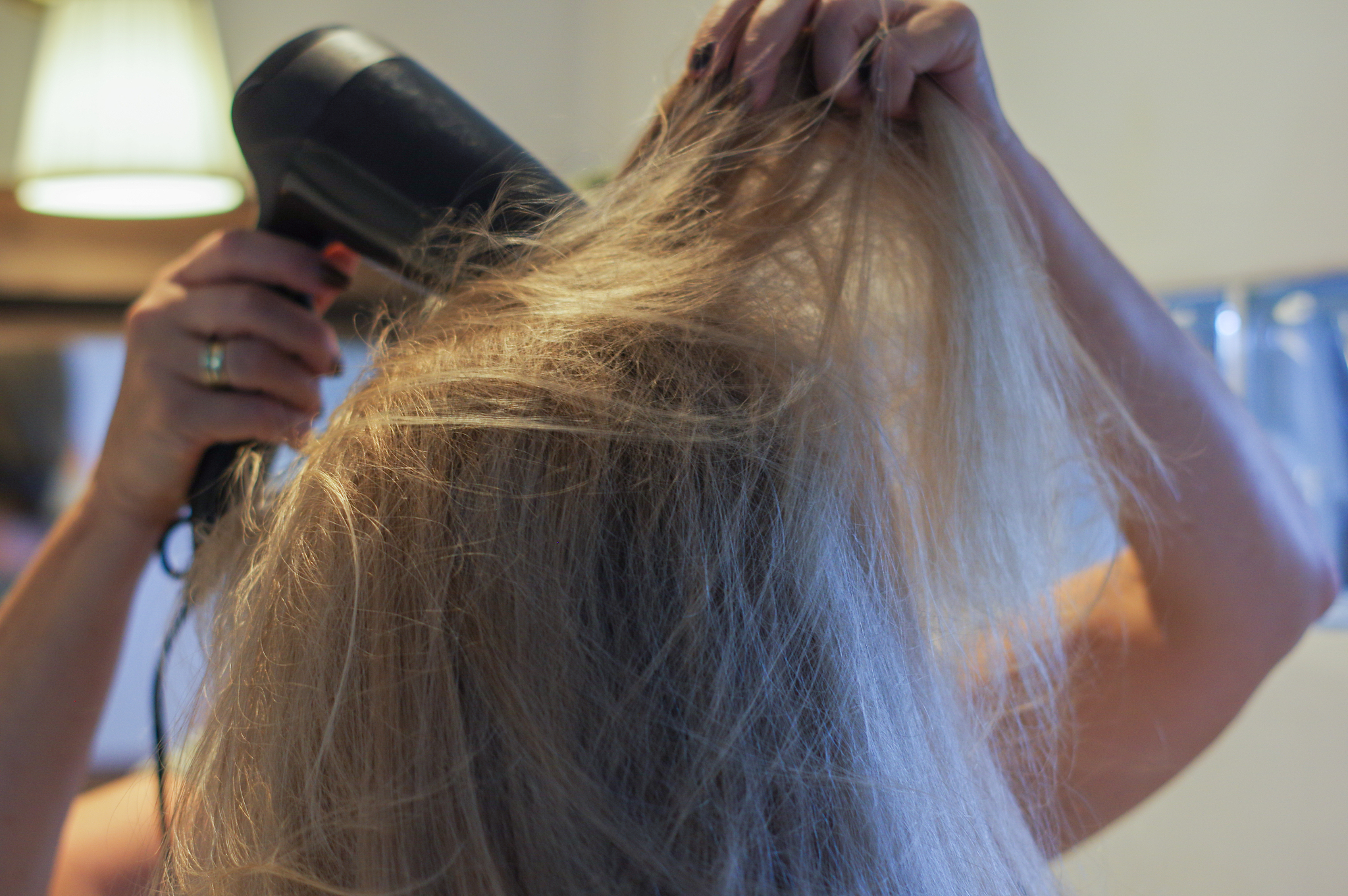 头发太油、太多头皮怎么办？