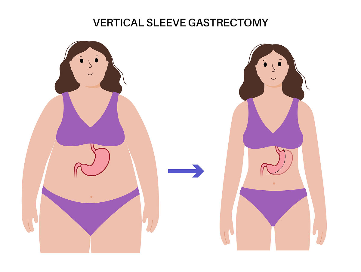 肚子大怎么瘦肚子
