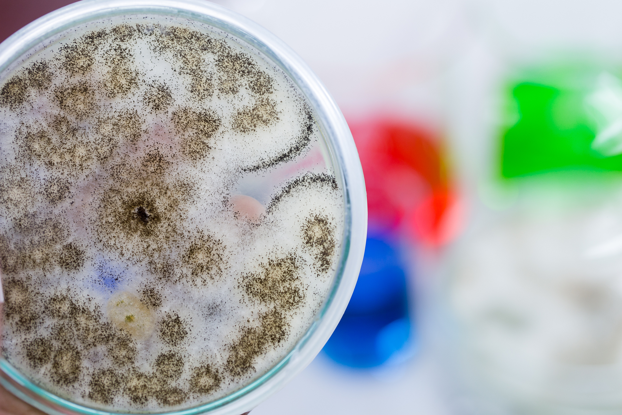 以《三年级时最严重的几次拉肚子》为题写一篇记叙文。详写第一次轮状病毒感染拉肚子上体育课拉肚子来不及去厕所。第二、三、四、五次分别由于细菌感染过期牛奶发霉面包贾第鞭毛虫感染。展现出不同种类拉肚子的不同症状