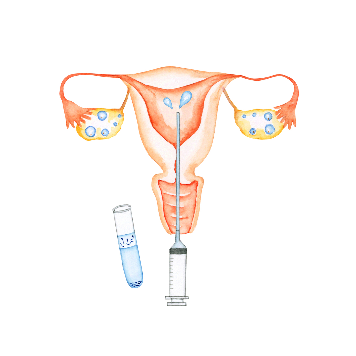 生成一份关于子宫憩室研究新进展的医学专业授课PPT文稿50页以上。