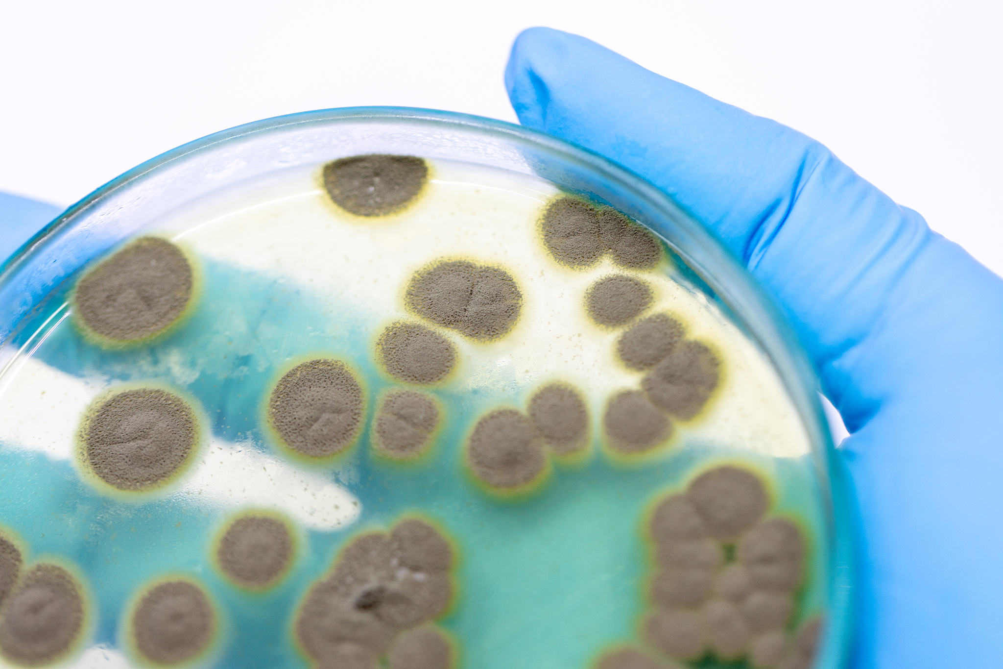 UC优势菌属的氧气需求类型：好氧、兼性厌氧或厌氧