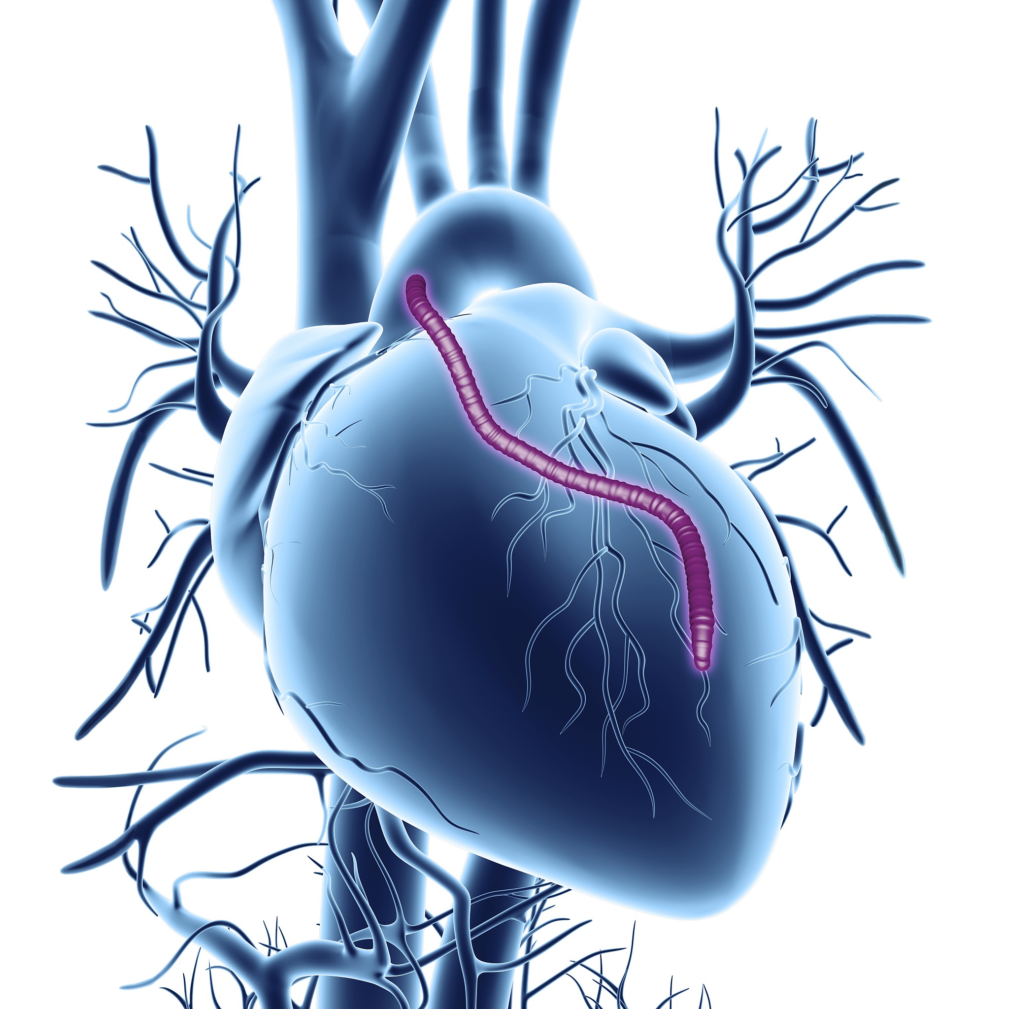 写一篇关于健康教育对冠脉造影术患者焦虑状况的影响的结果讨论。