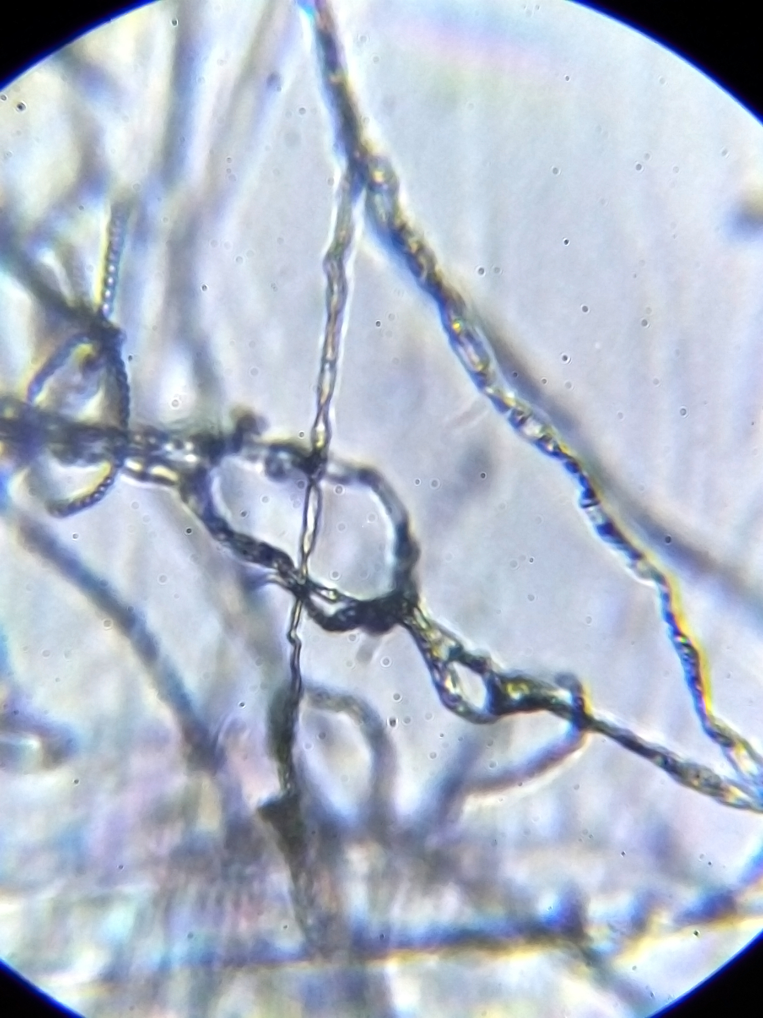 霉菌与放线菌的不同