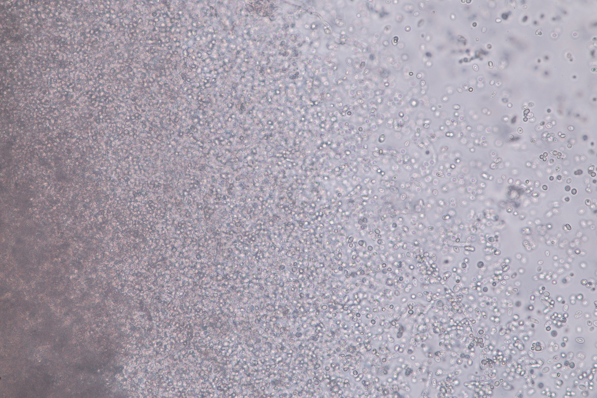 46XXinv9p12q13的生育风险