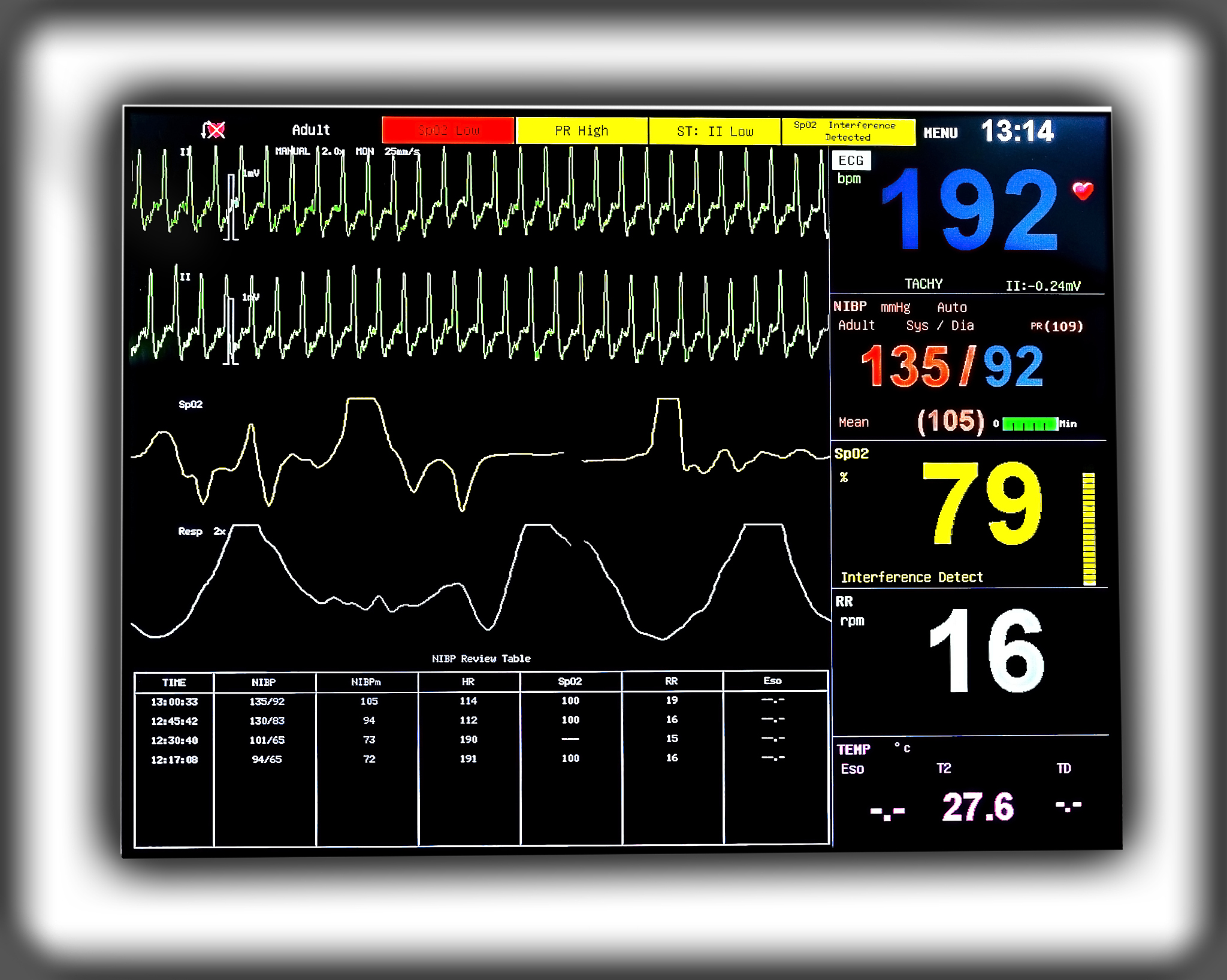 将以下数据加上英文引号心率：91体重：751体温：363低压：55高压：123血氧饱和度：099心率：70体重：749体温：365低压：67高压：134血氧饱和度：098心率：67体重：752体温：366低压：90高压：143血氧饱和度：098心率：79体重：750体温：360低压：78高压：132血氧饱和度：097心率：77体重：751体温：361低压：76高压：123血氧饱和度：099心率：7