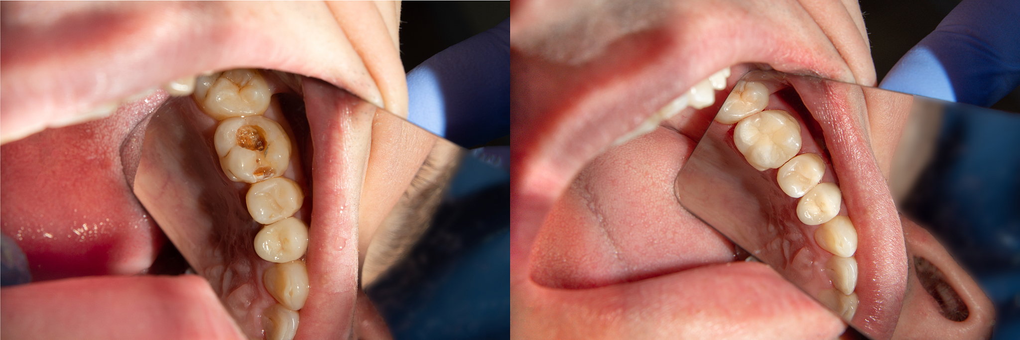 重庆市卫校口腔护理专业课程详解：学什么？