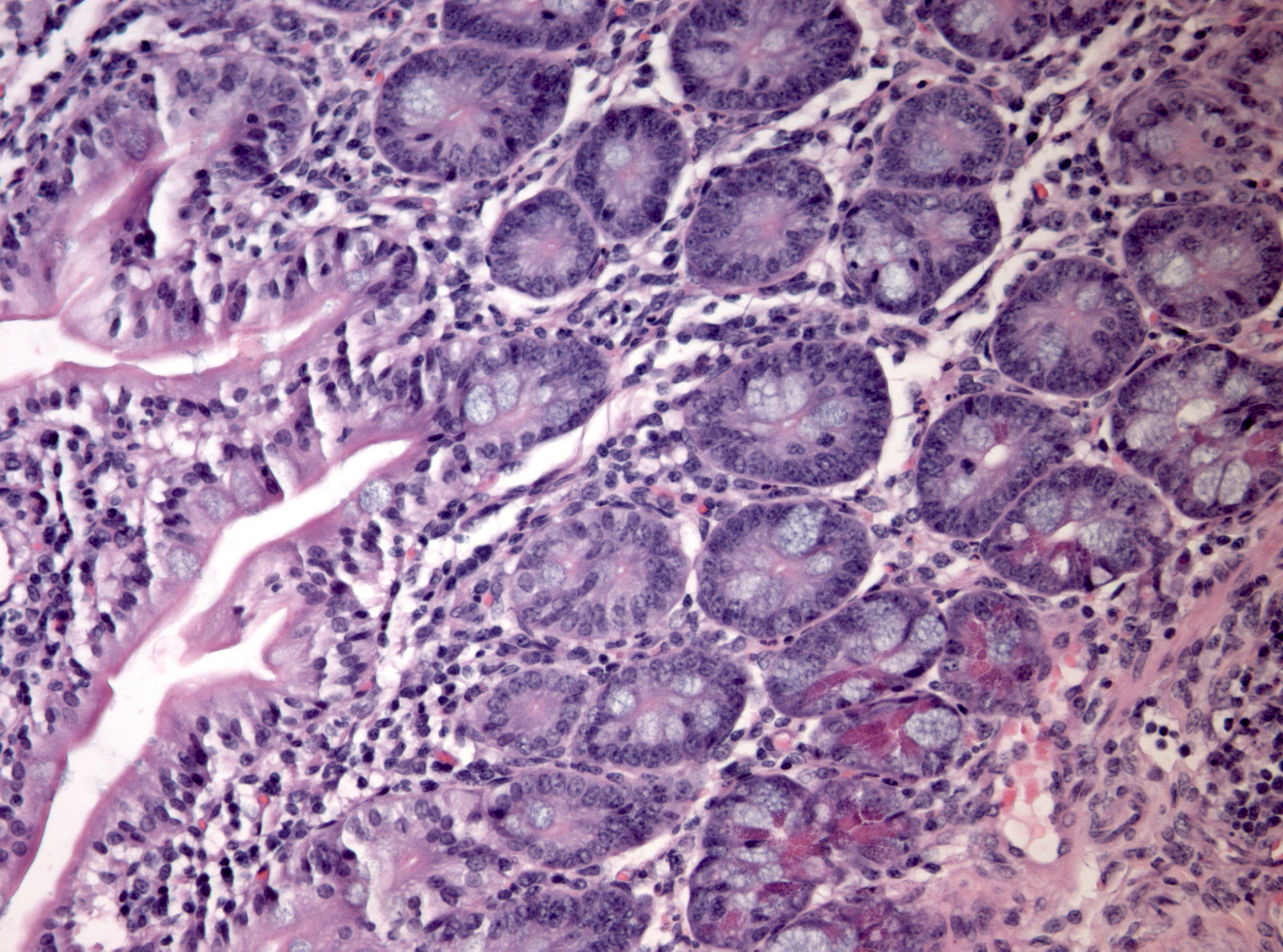 大便是什么？颜色、形状、气味解读你的健康密码