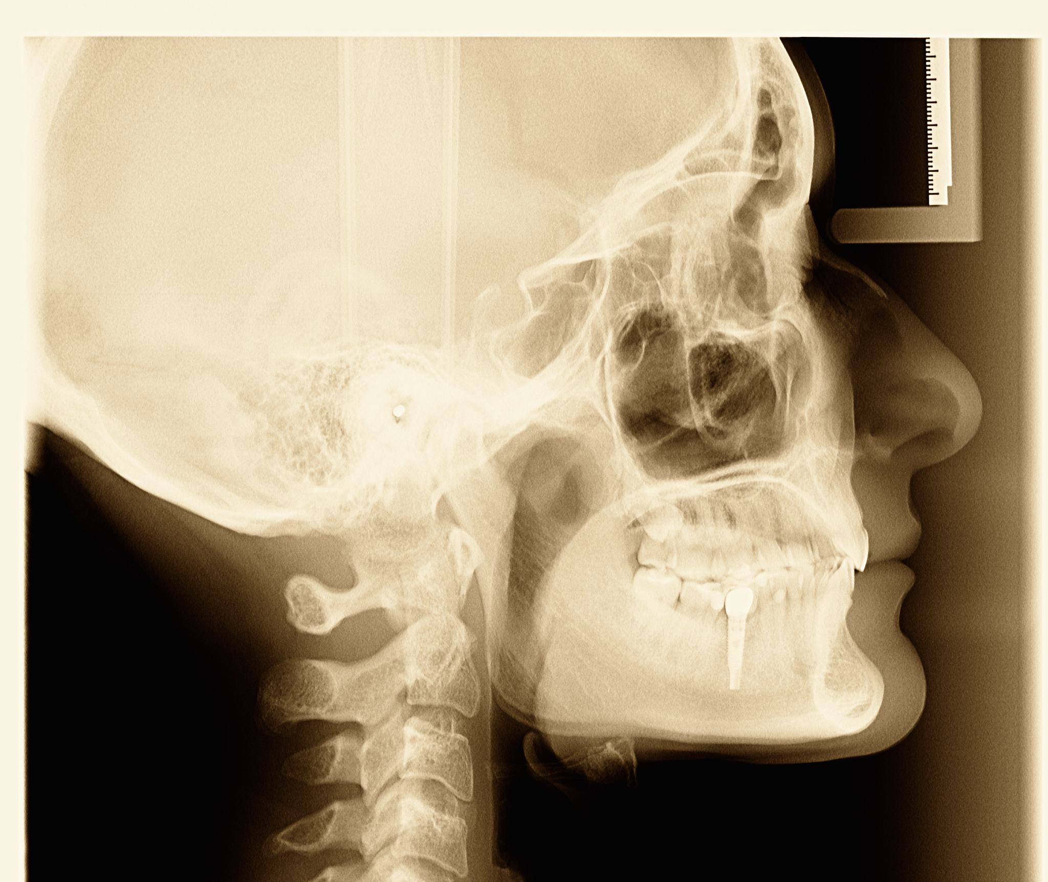 西宁卫生职业技术学校2022年招生专业一览：临床医学、护理等热门专业等你来选