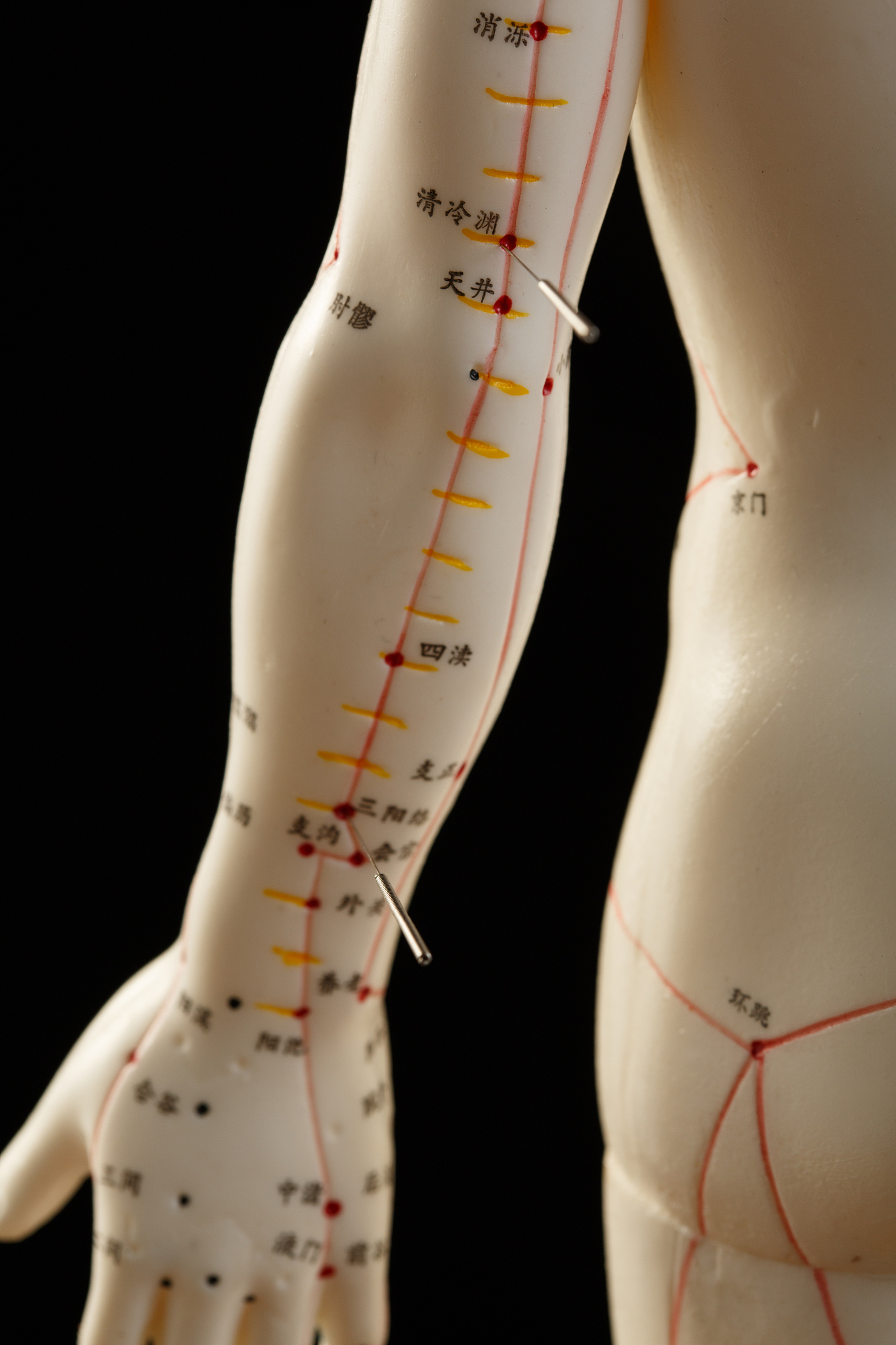 中风，中经络，主穴：水沟、内关、三阴交、极泉、尺泽、委中。配穴：肝阳暴亢，配太冲、太溪；风痰阻络，配丰隆、风池；痰热腑实，配曲池、内庭、丰隆；气虚血瘀：配足三里、气海。
以上是关于中医针灸学的文本。请把文本的原句适当修改，编写成容易记忆的歌诀。