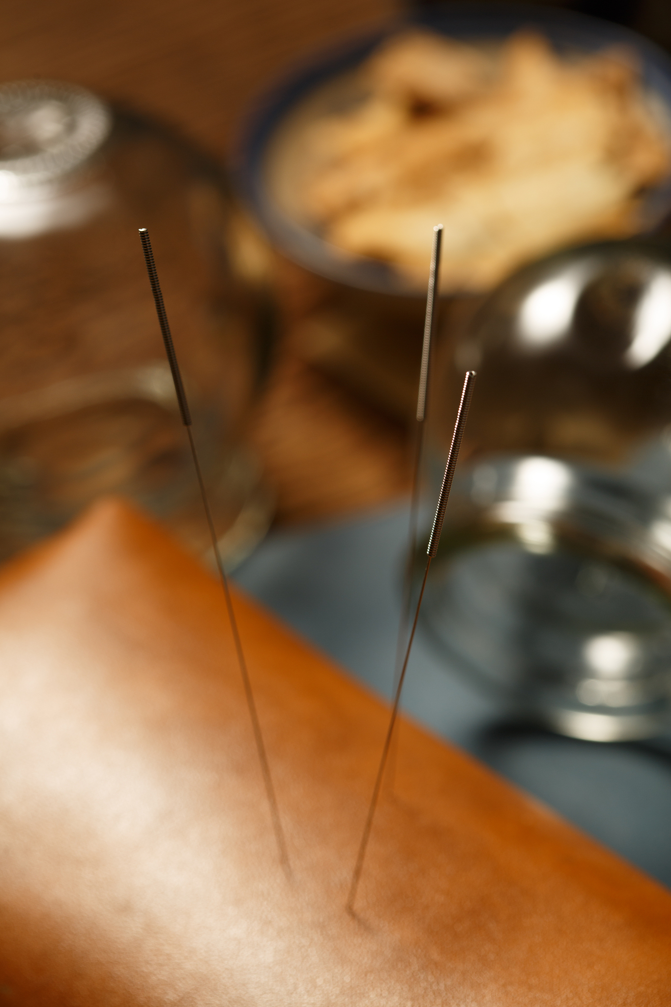 七星针功效与作用：调节气血、缓解疼痛、改善免疫力