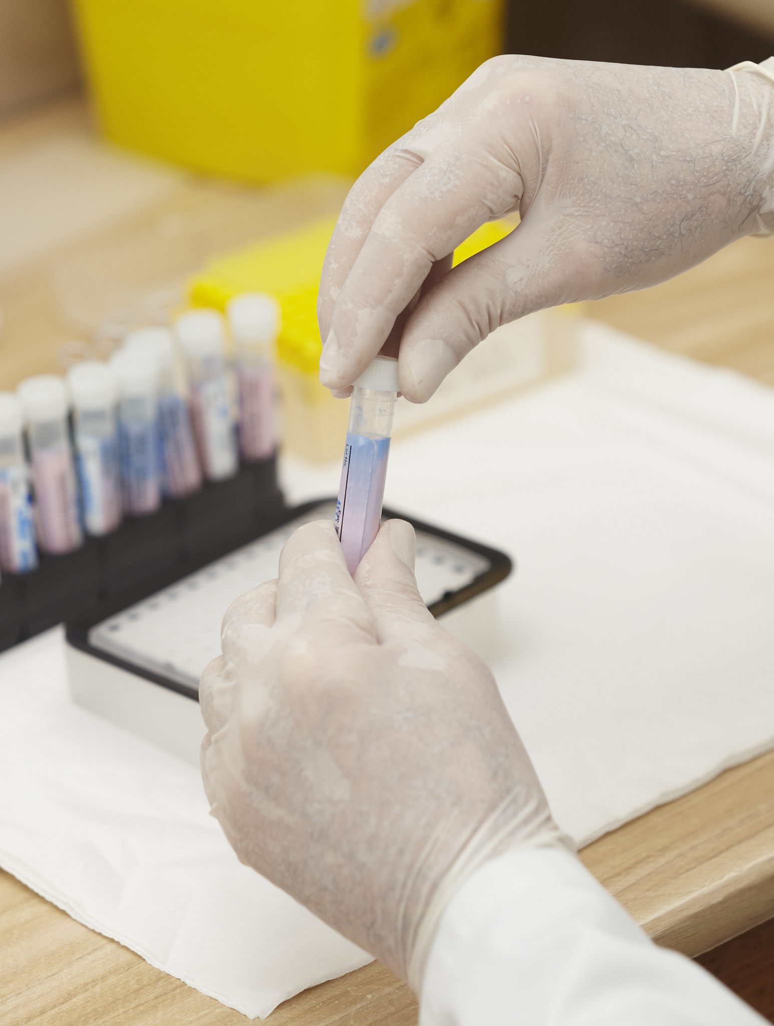 胰岛素笔注射实验心得