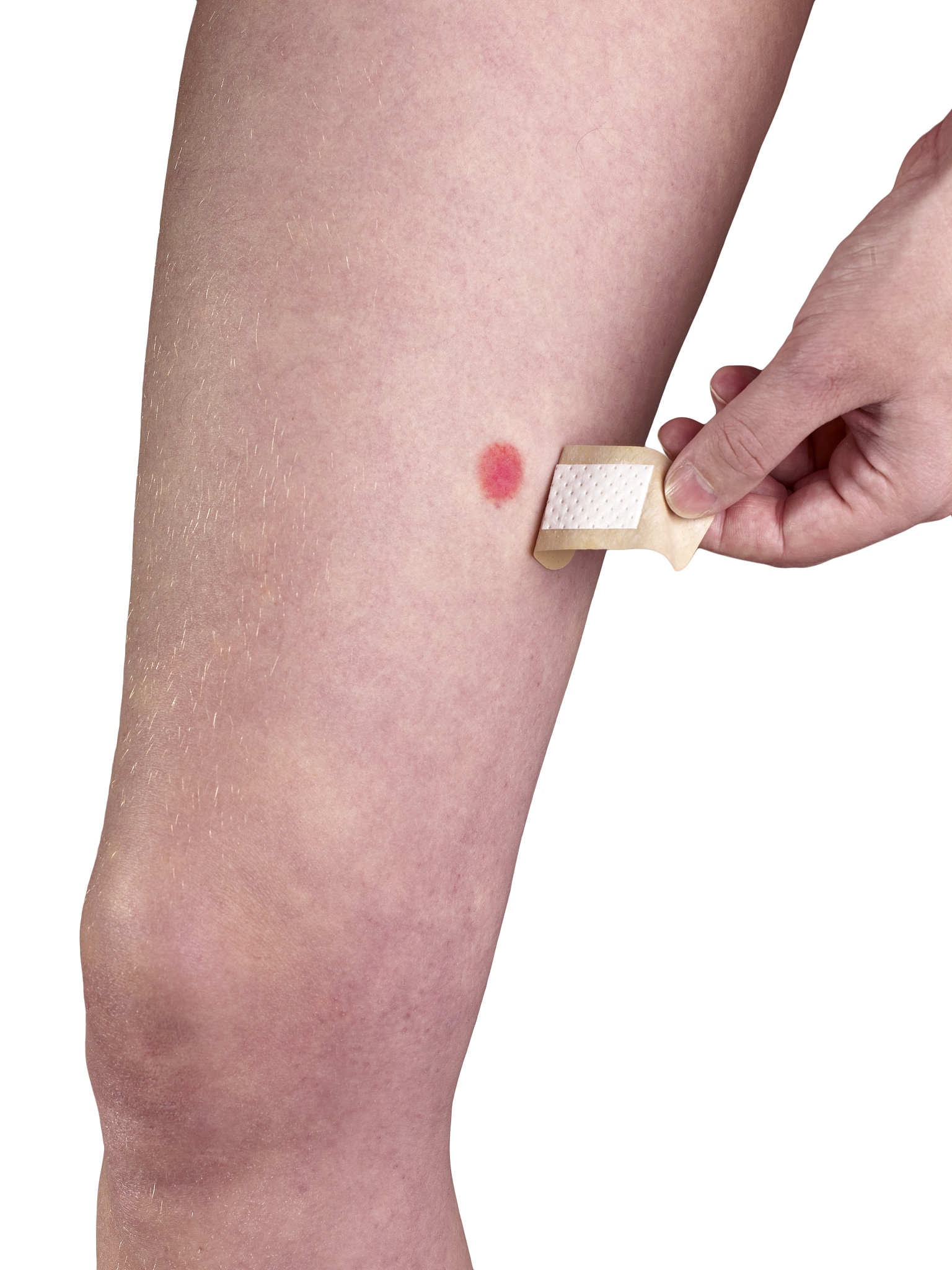 快速消除身上压痕的5个方法