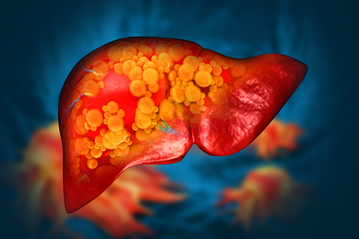 优化创意中文爆款标题3个字数要求不少于60字：转氨酶升高不只是肝炎的专属？这8个因素或是转氨酶升高的主因