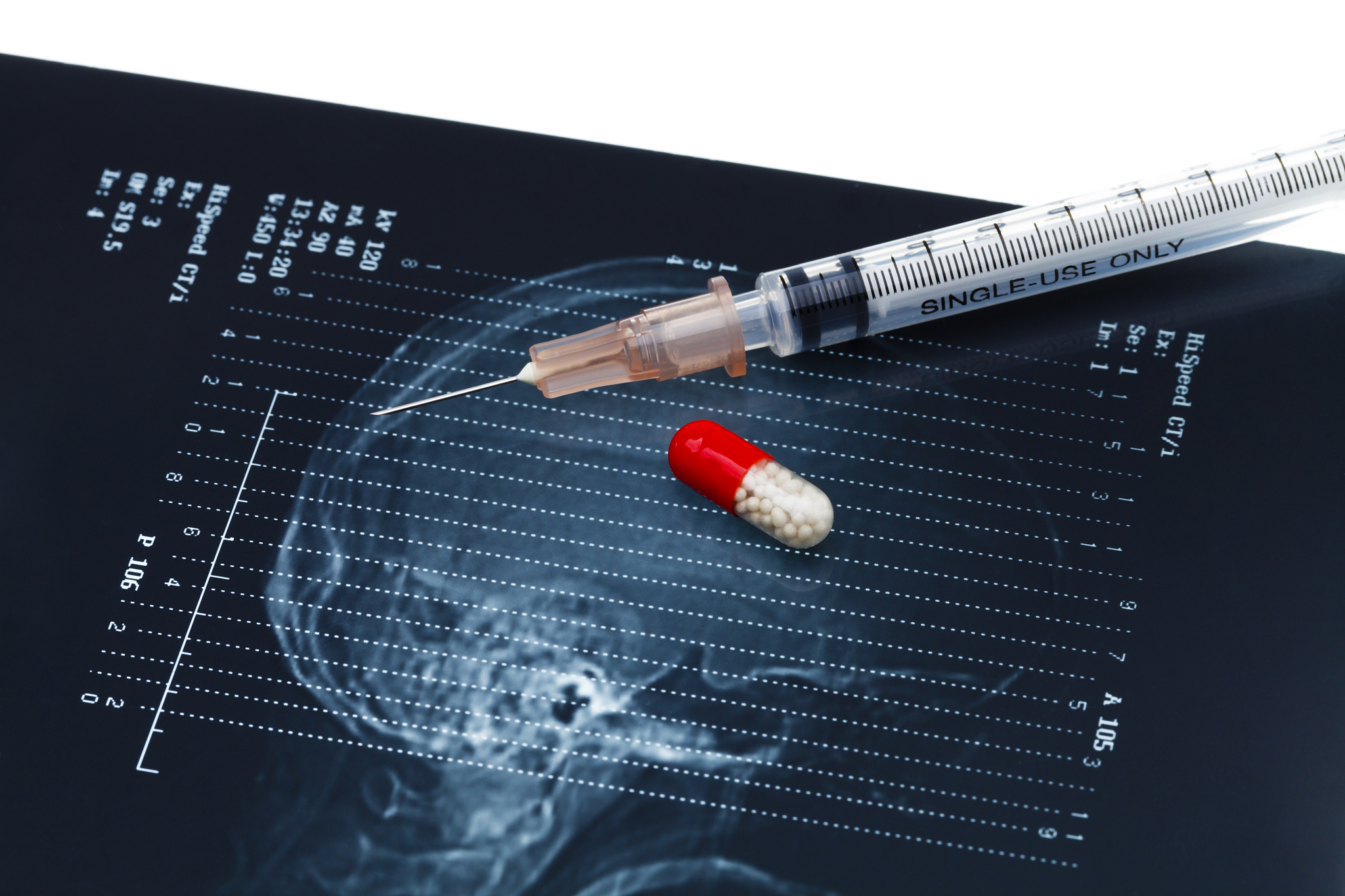 猫GM1神经节苷脂贮积症的检测诊断