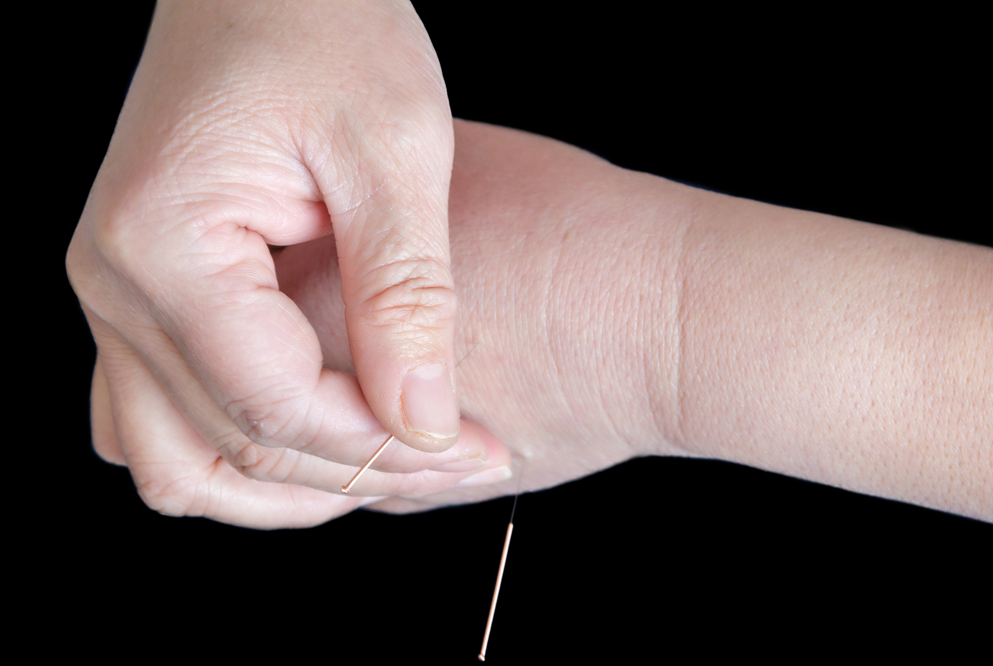 针灸推拿的就业前景怎么样用发