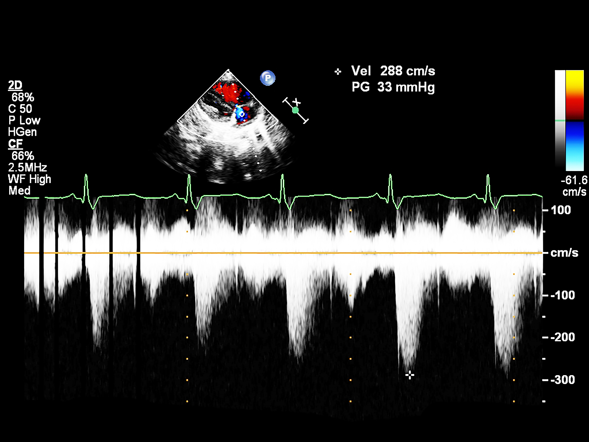 机械波：横波、纵波及特性深度解析