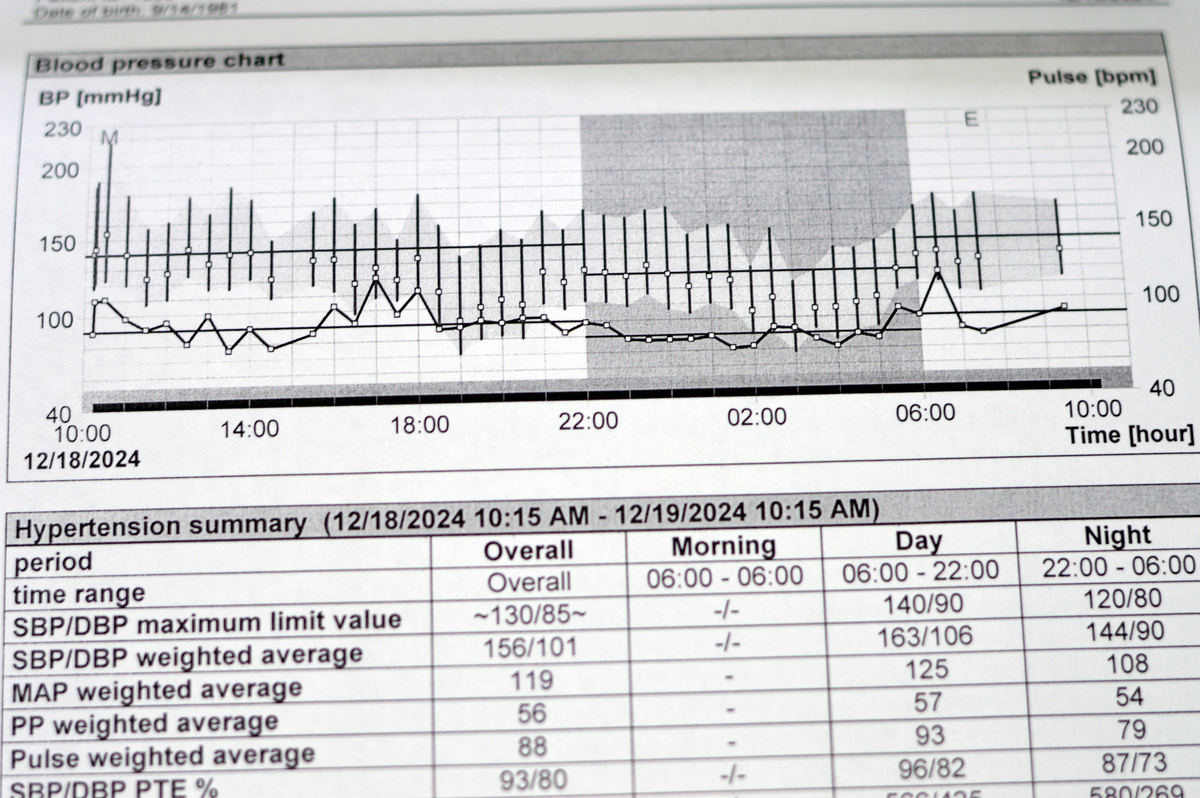 Android 2000个数据判断正常心跳波形方法