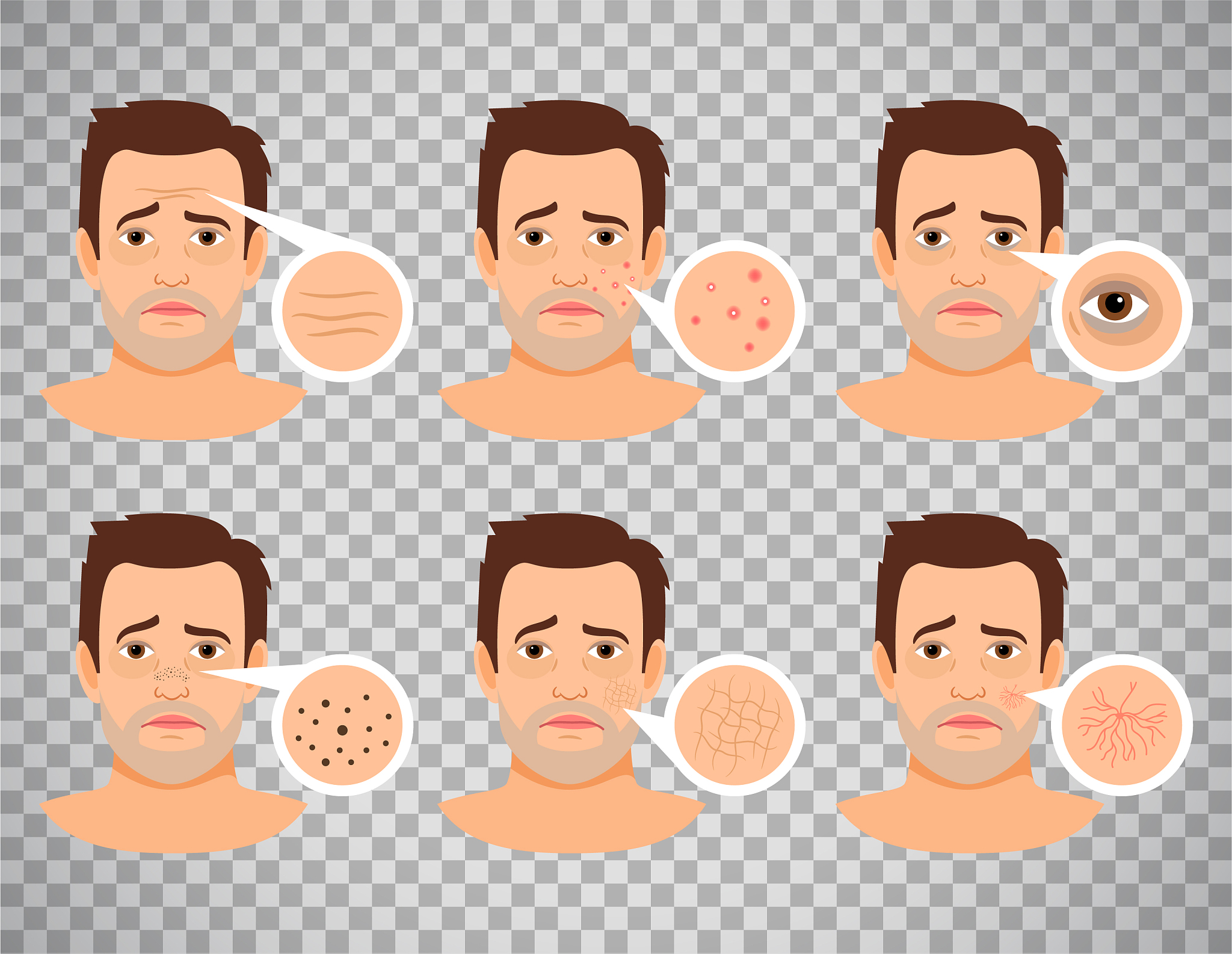 长痘能涂保湿乳吗？如何选择适合的保湿产品