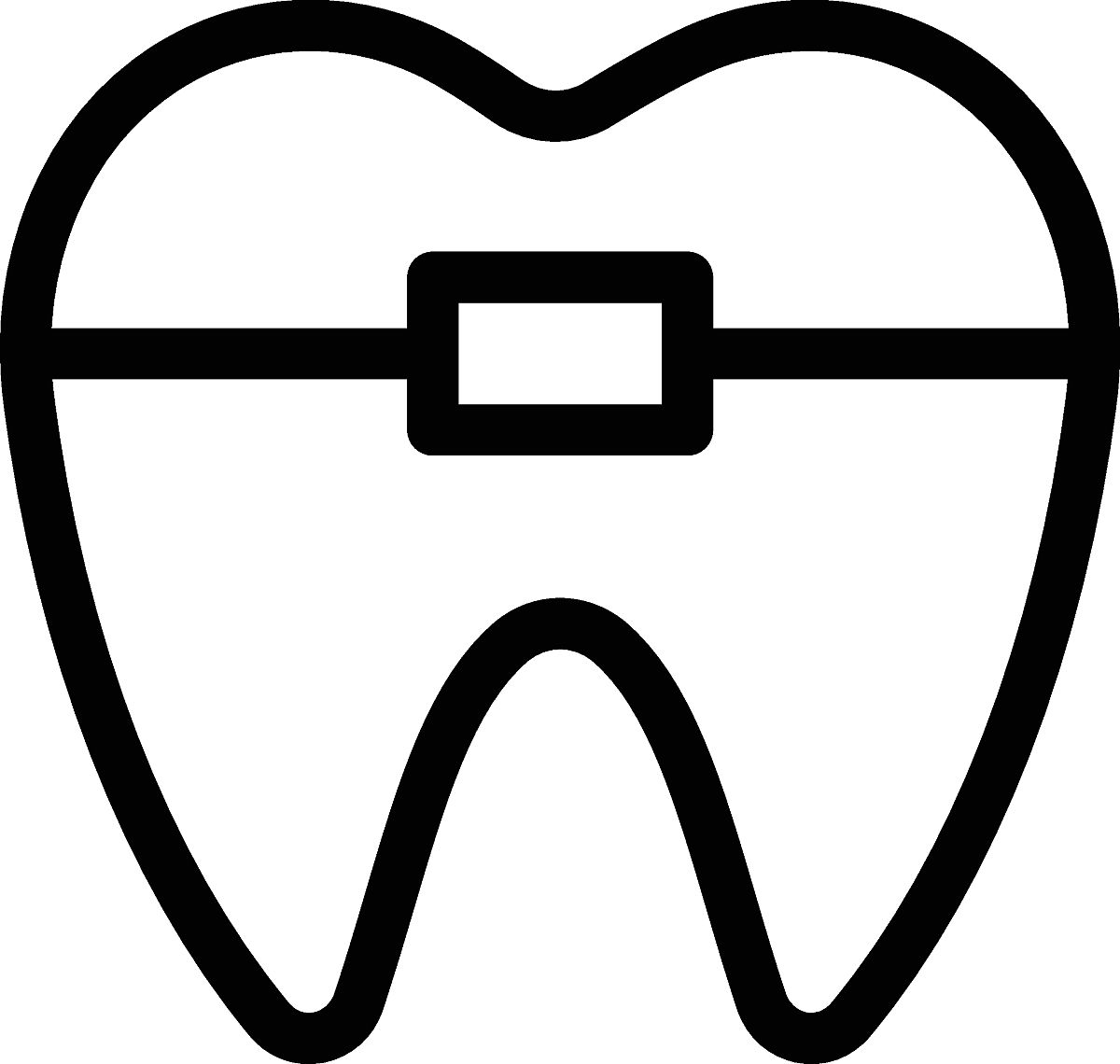 记录佩戴时间的牙套：种类、功能与选择建议