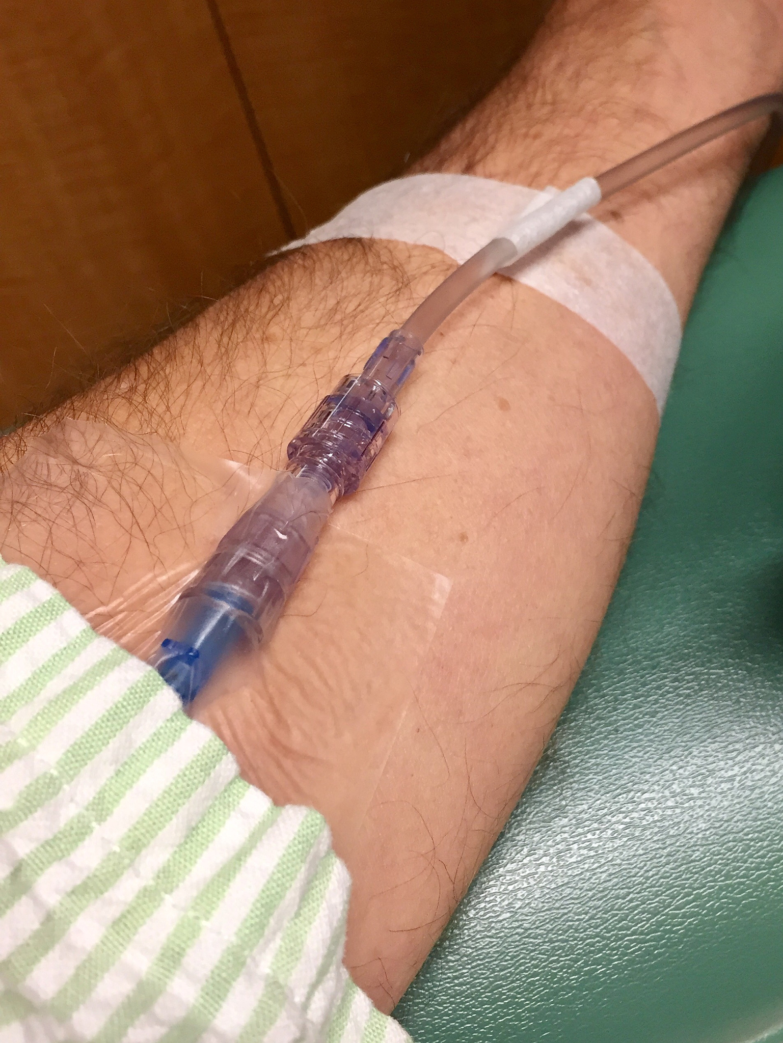 微创组织松解器：抽脂术后修复和组织粘连治疗的创新解决方案