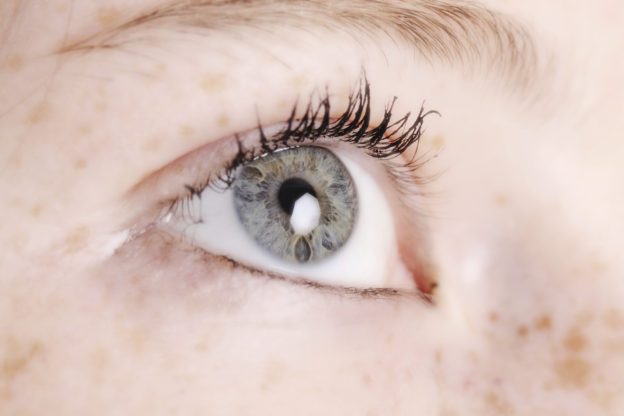 teen eye