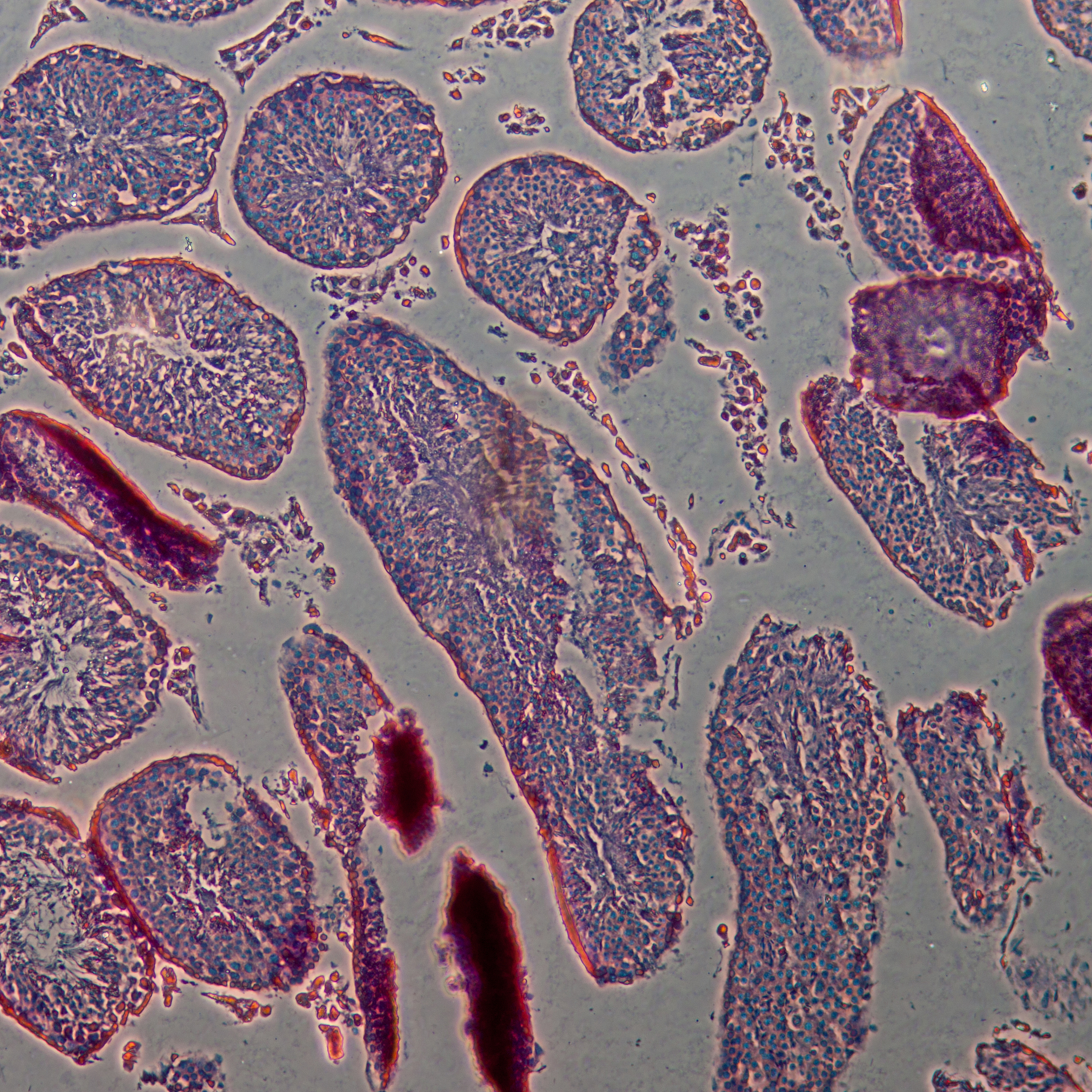 将口服途径攻毒的ICR乳鼠的各组织器官研磨、过滤后分别接种至Marc-145细胞结果显示接种肠部、脑部组织液的细胞在接种的第2天就出现明显病变而接种乳鼠其他组织液的细胞在接种后4天仍未观察明显病变具体情况与图中的肺部组织相似。检查语病并进行适当改写