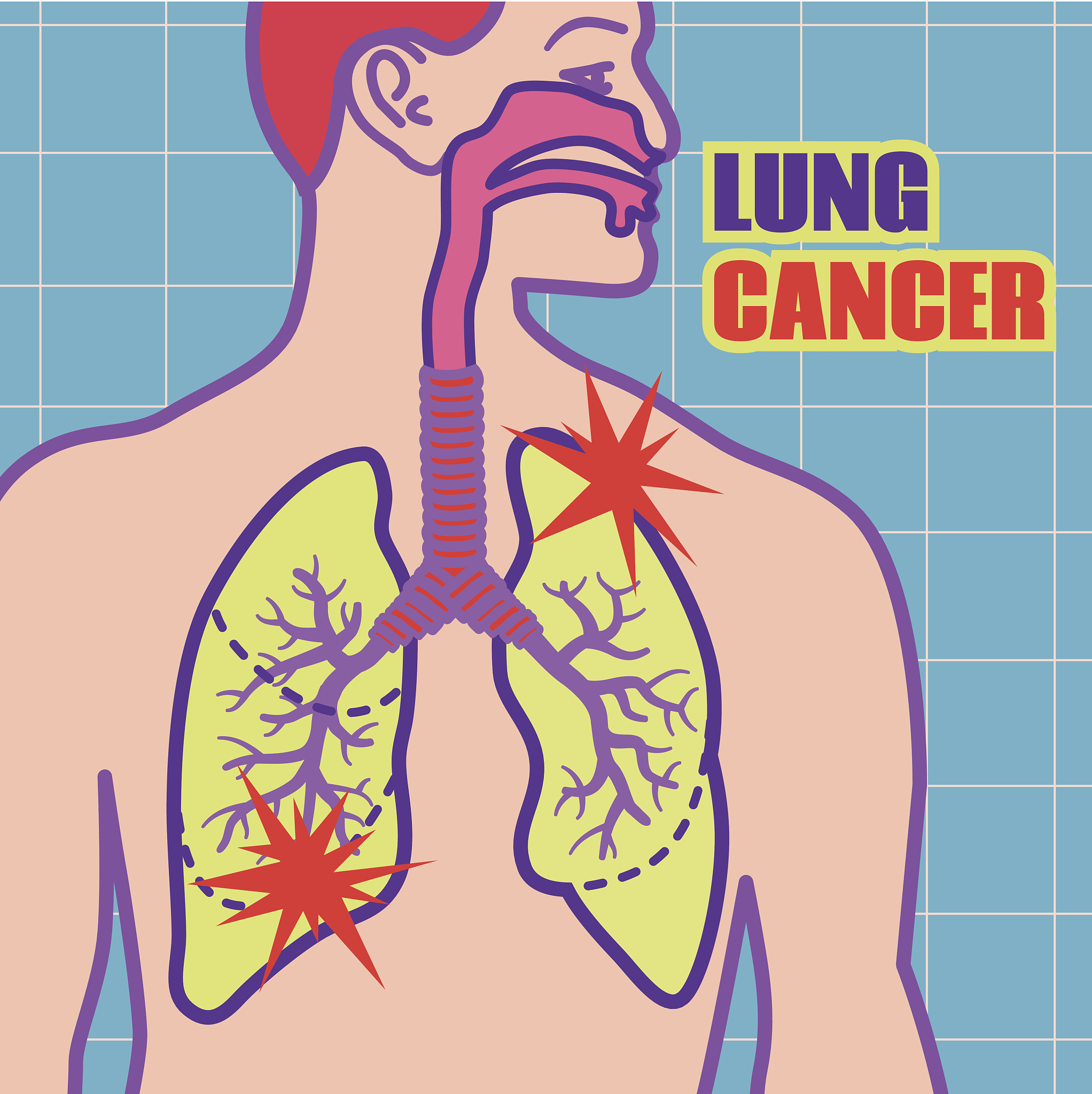 写一个肺部肿瘤的科普文章