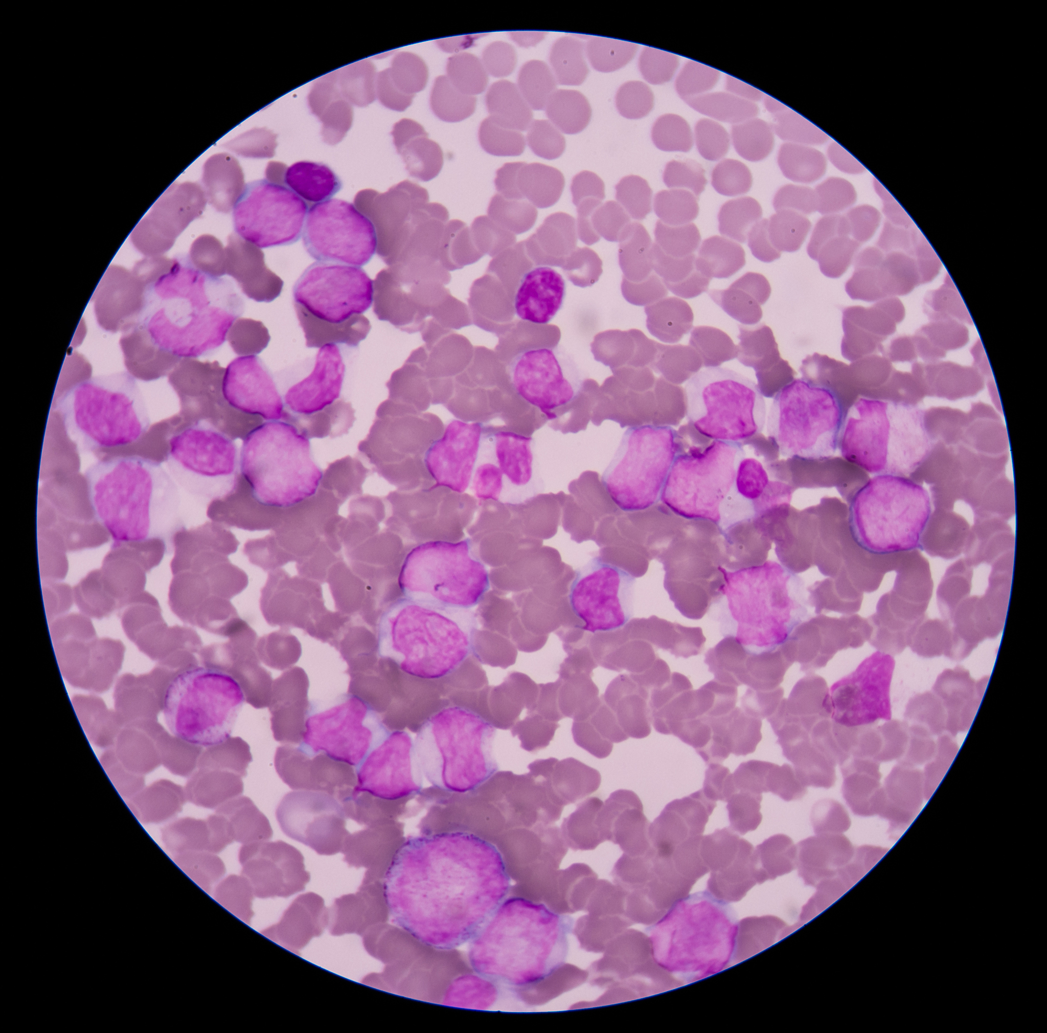 离心血液不同成分：温度要求指南