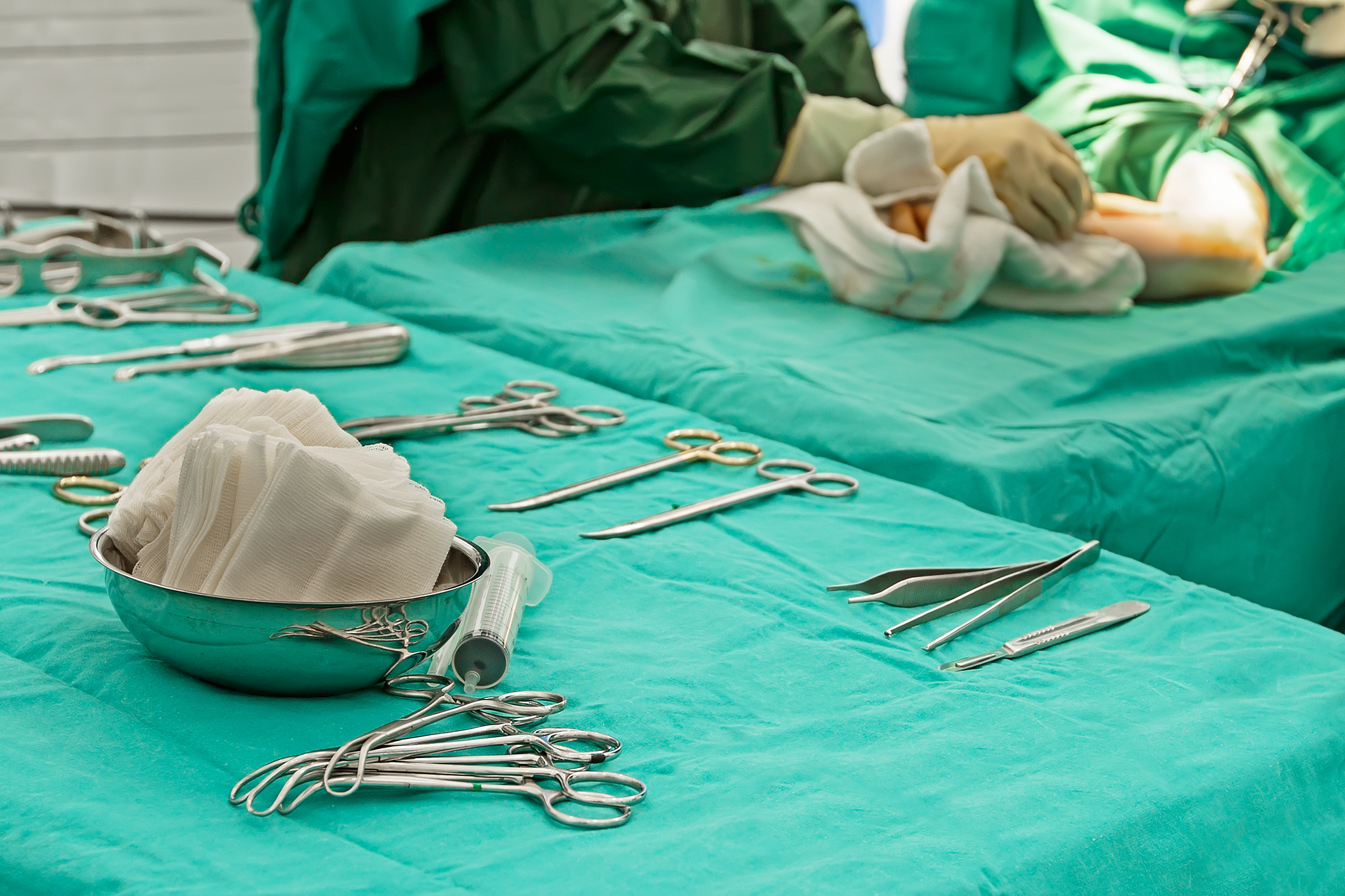 operating table, surgical scissors and a arm surgery