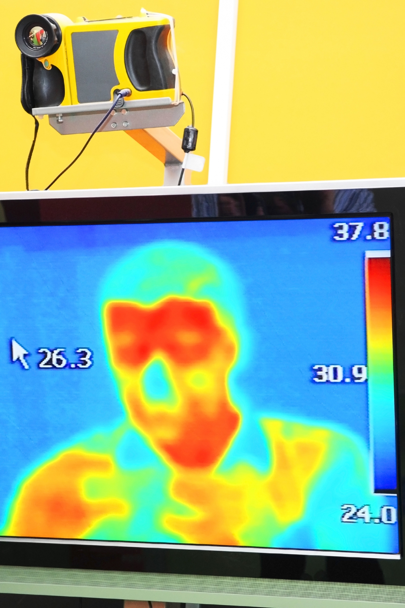 Vision sensors are all the type of sensor that can return an imageRGB Cameras visual aspectInfrared thermal image temperature monitoringXray Quality control翻译