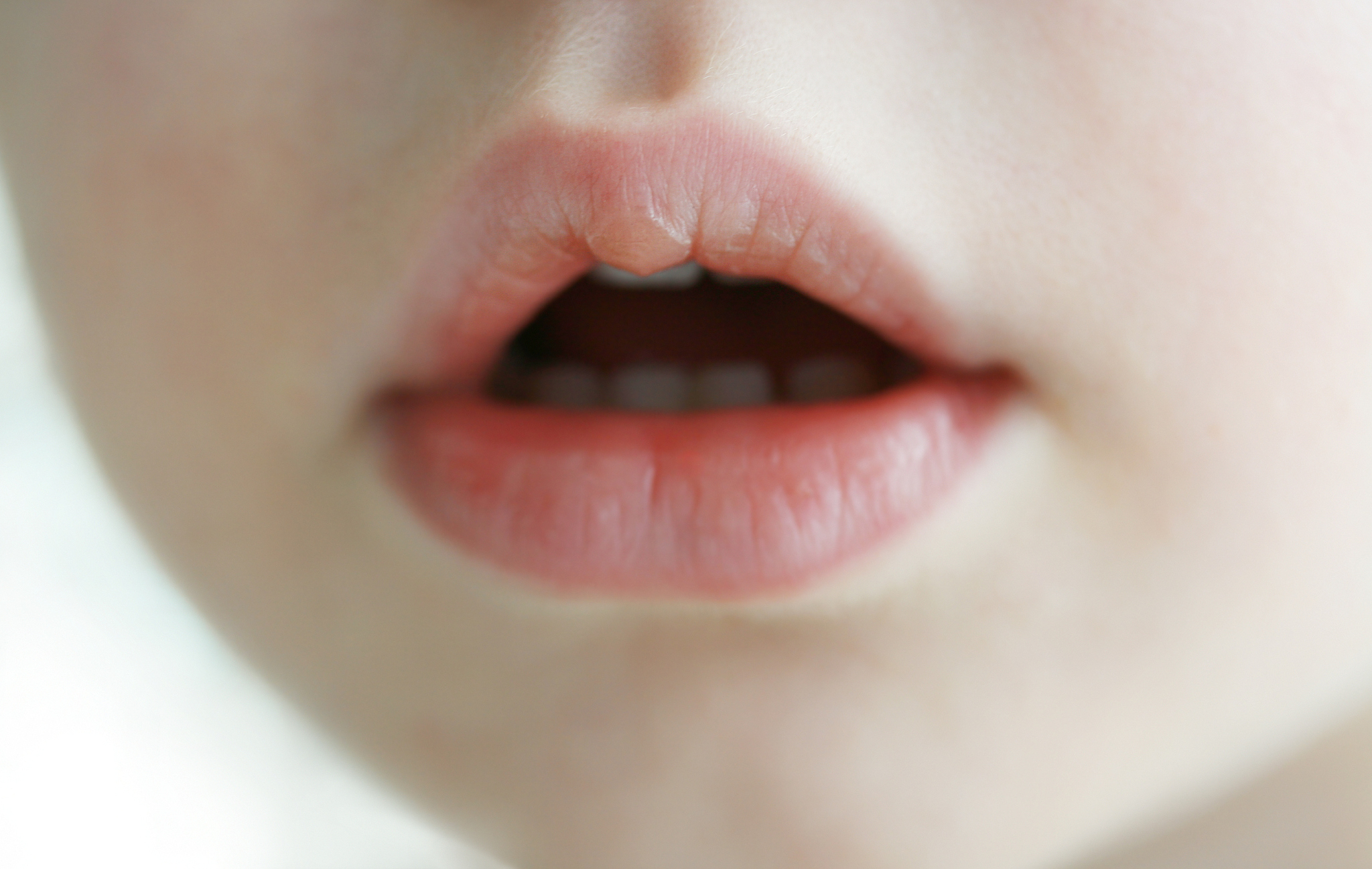 宝宝嘴巴周围长了红色的点点不是嘴巴里面就嘴唇周围有部分有点像脂肪粒但是是红色的