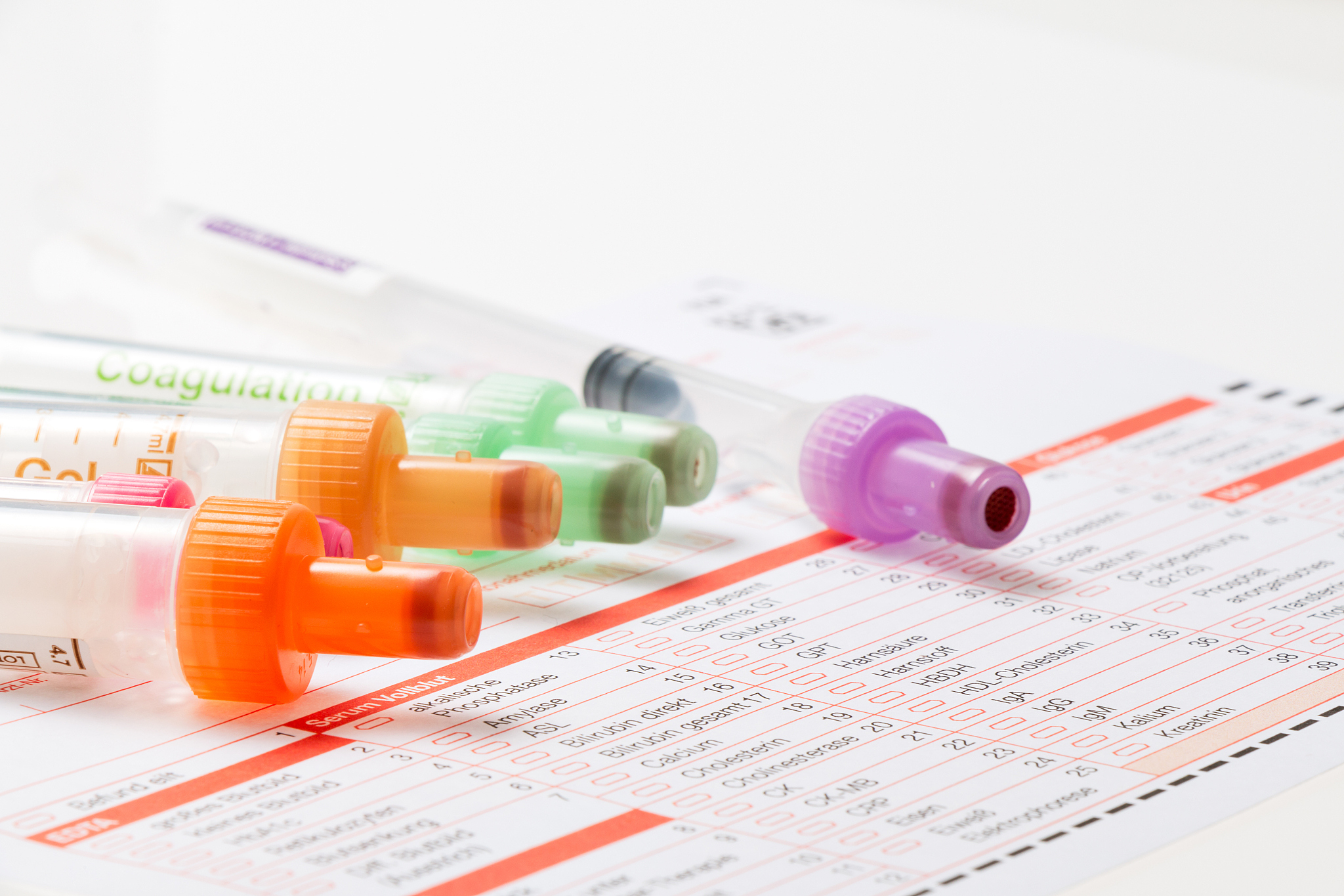 帮我写一份沂蒙山验血报告