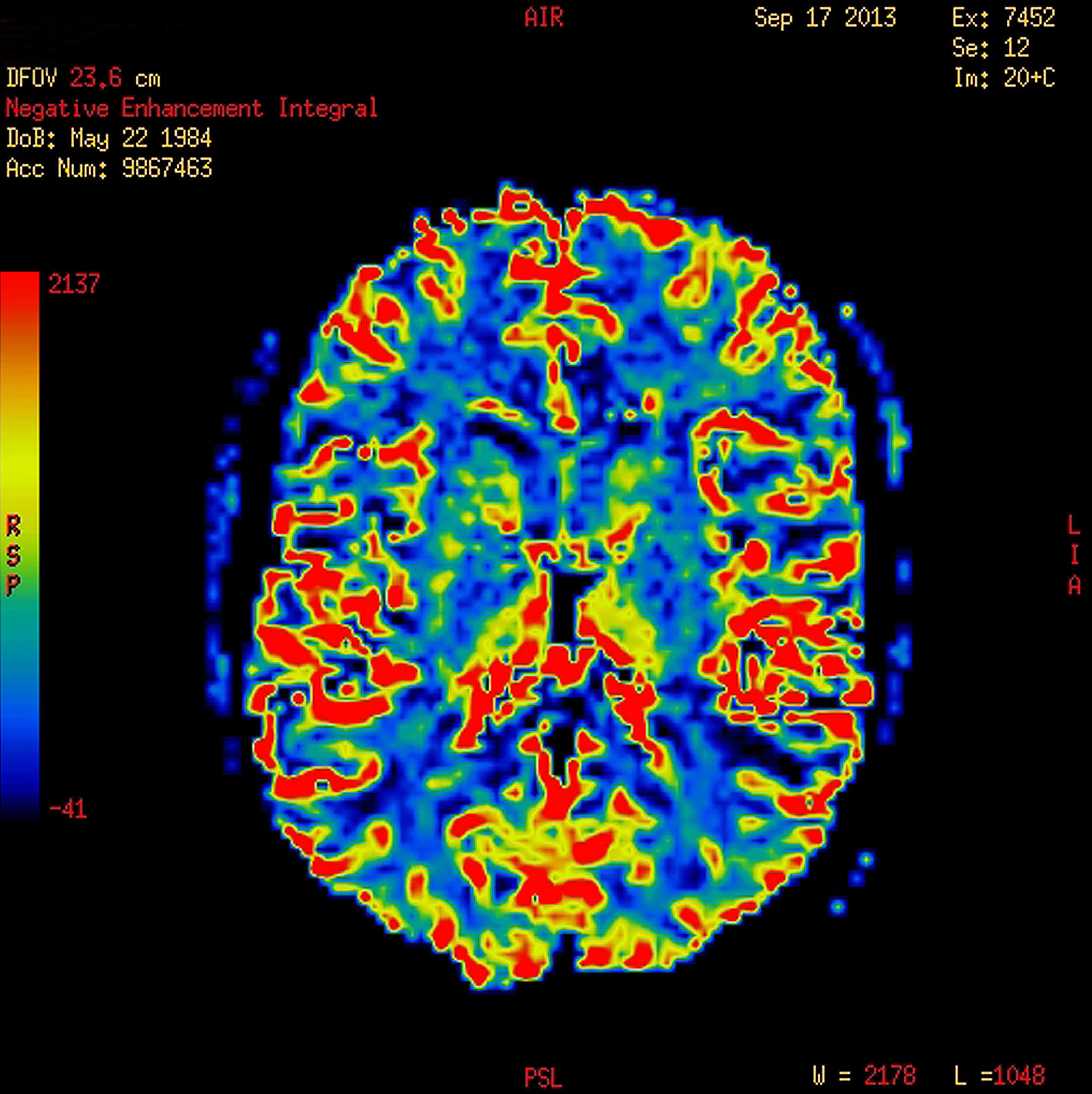 解释一下 output_brain_file = ospathjoinoutput_dir brain_ + file ossystembet -mformatinput_file output_file ossystemfslmaths -mas formatinput_file output_file output_brain_file每一句的作用