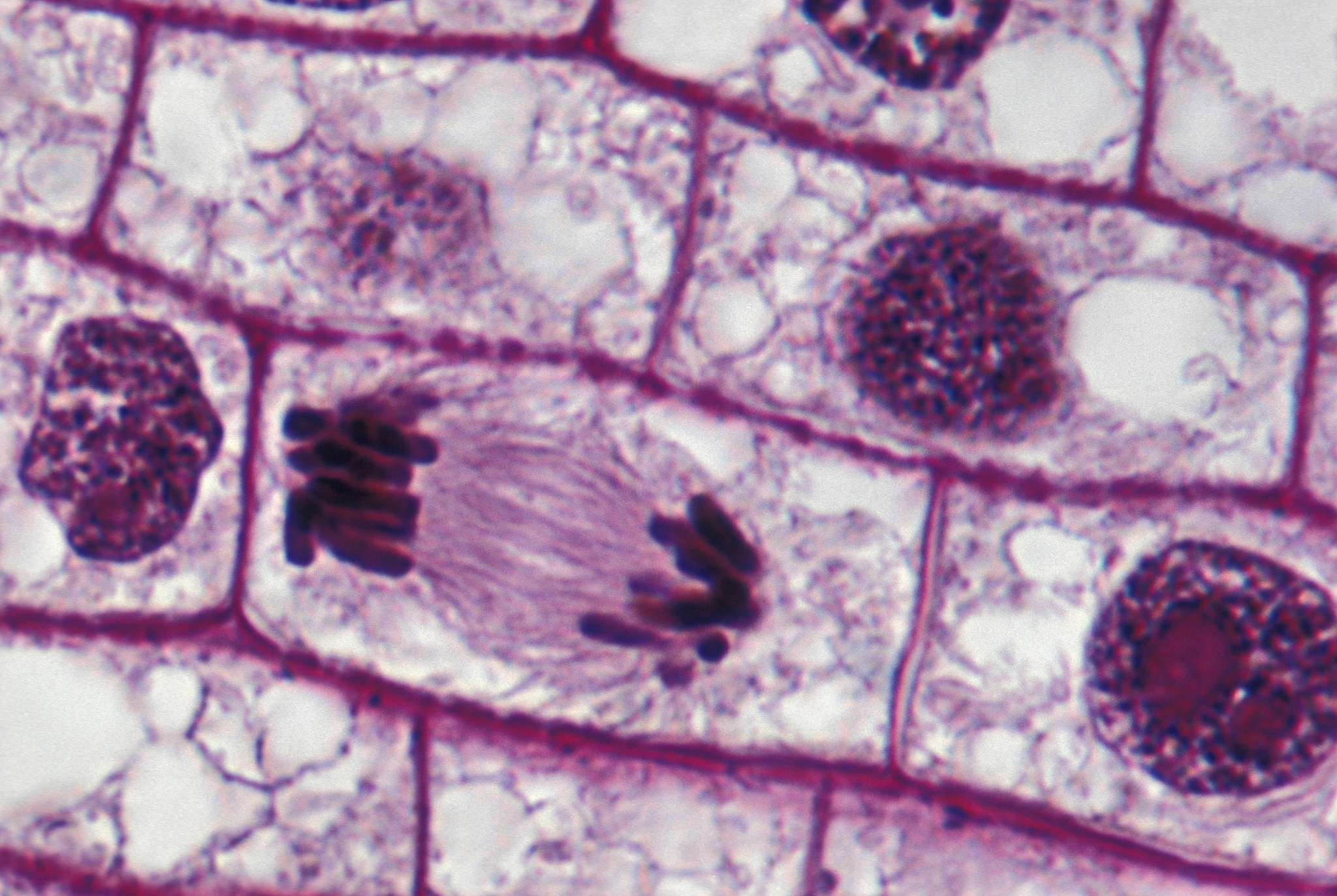 根尖分生组织细胞有丝分裂：植物生长关键