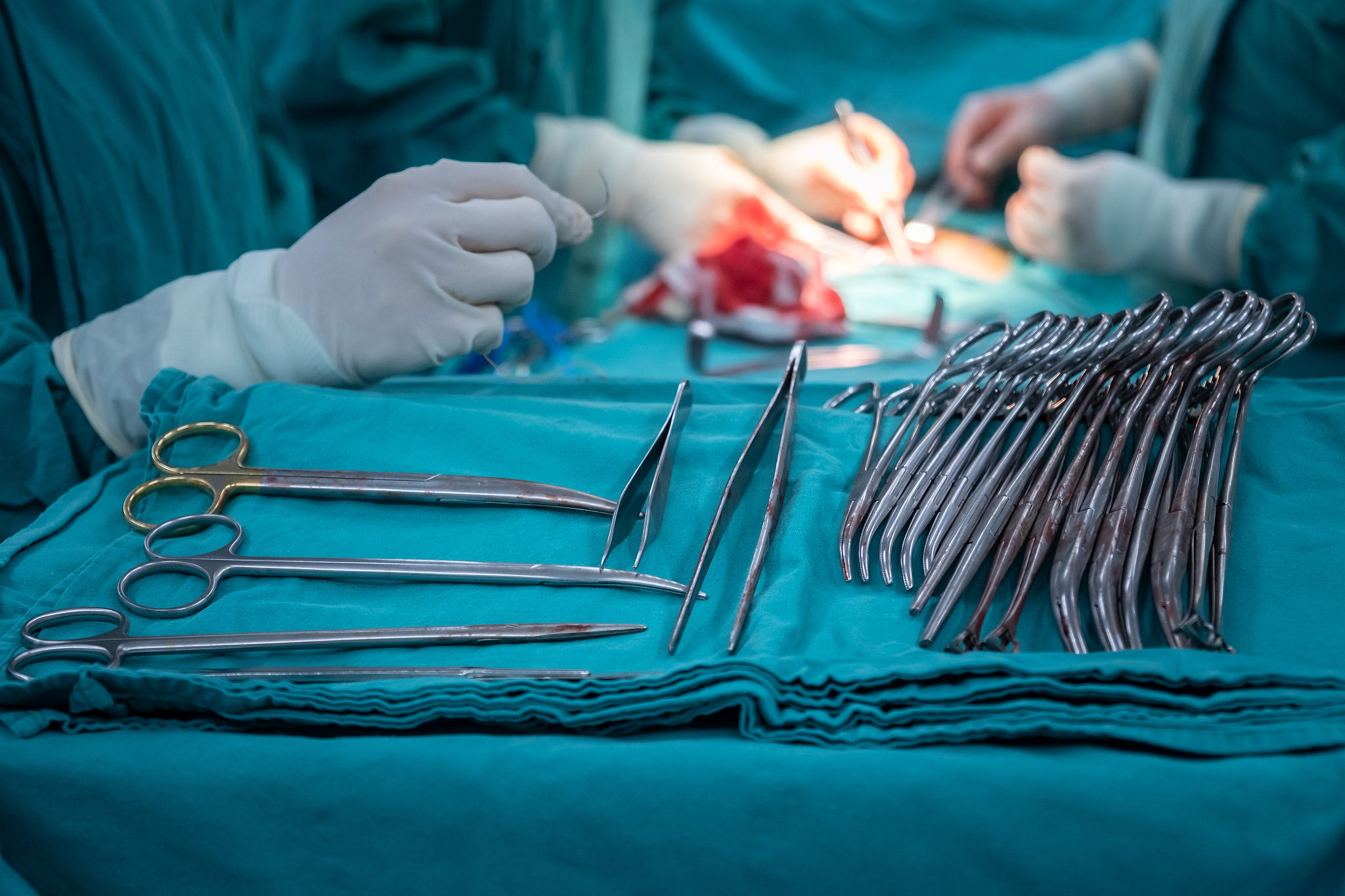 group of surgical instruments used in surgical operation in oper