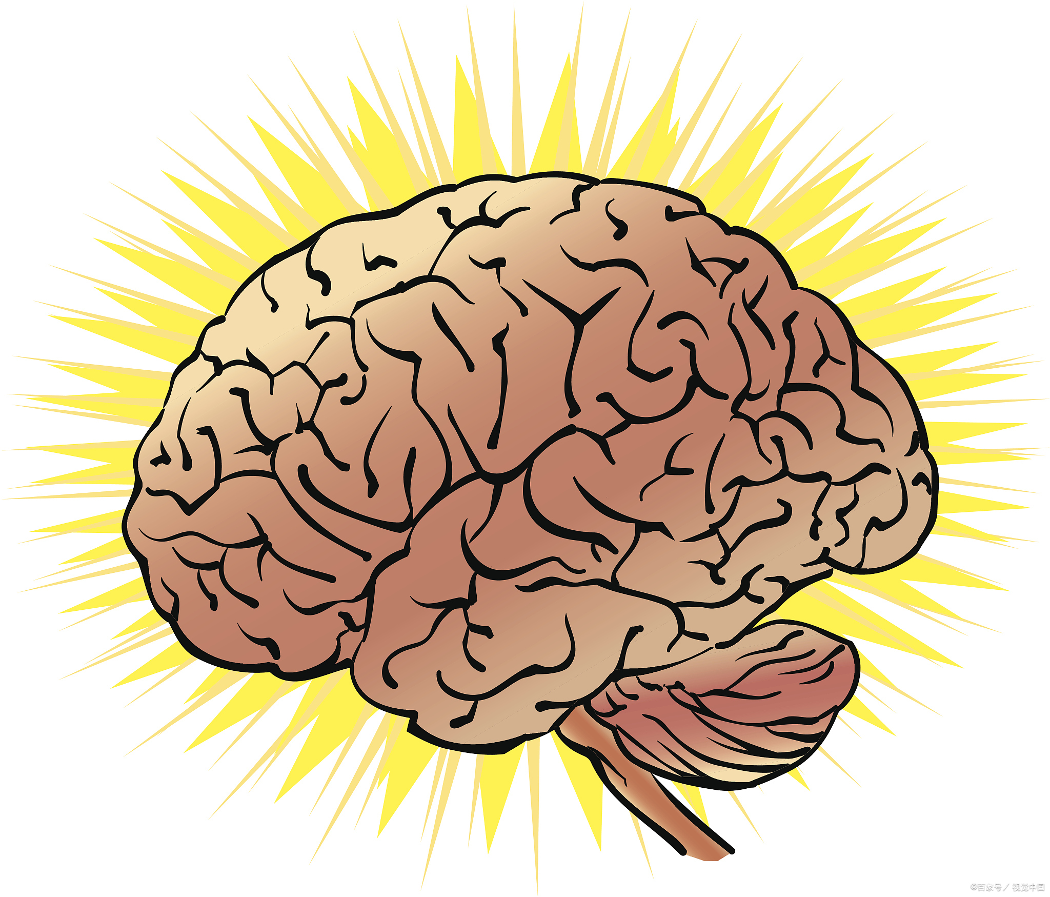 继发性蛛网膜下腔出血：科学治疗，守护生命之光