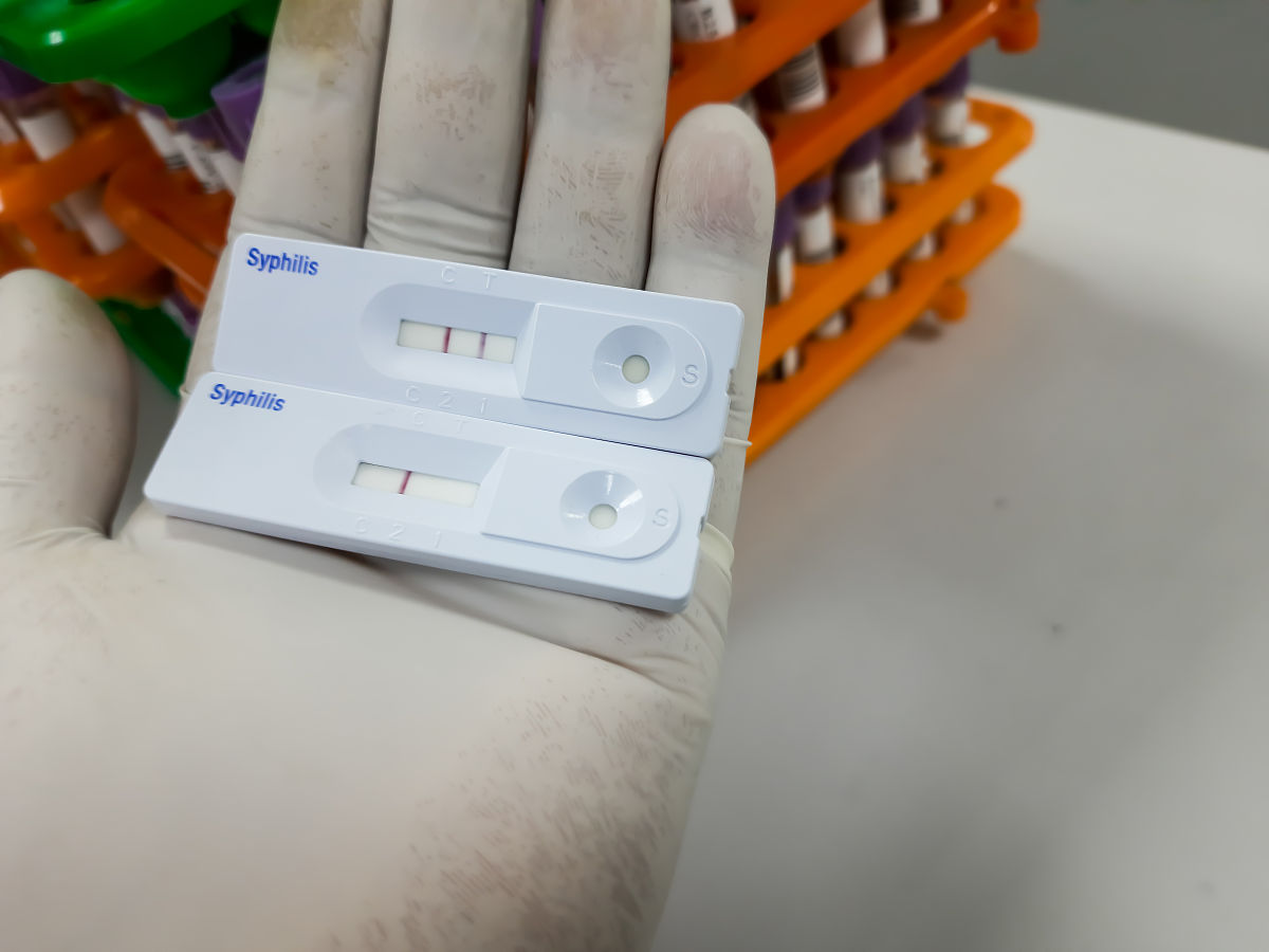 性传播疾病试纸条: 类型、使用方法及注意事项