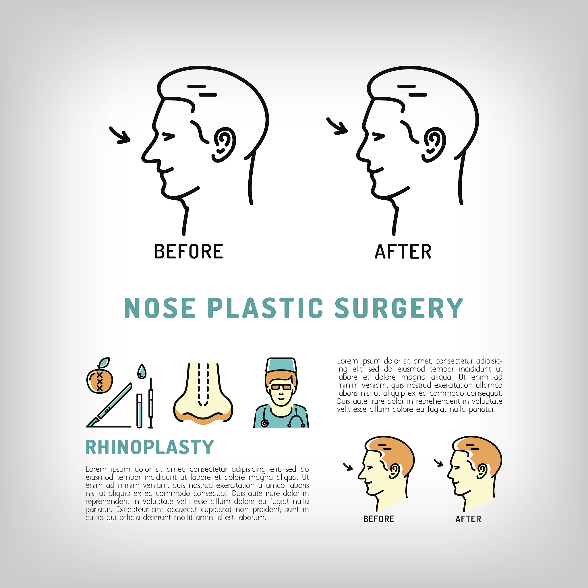肋软骨隆鼻朋友圈爆款文案不少字于