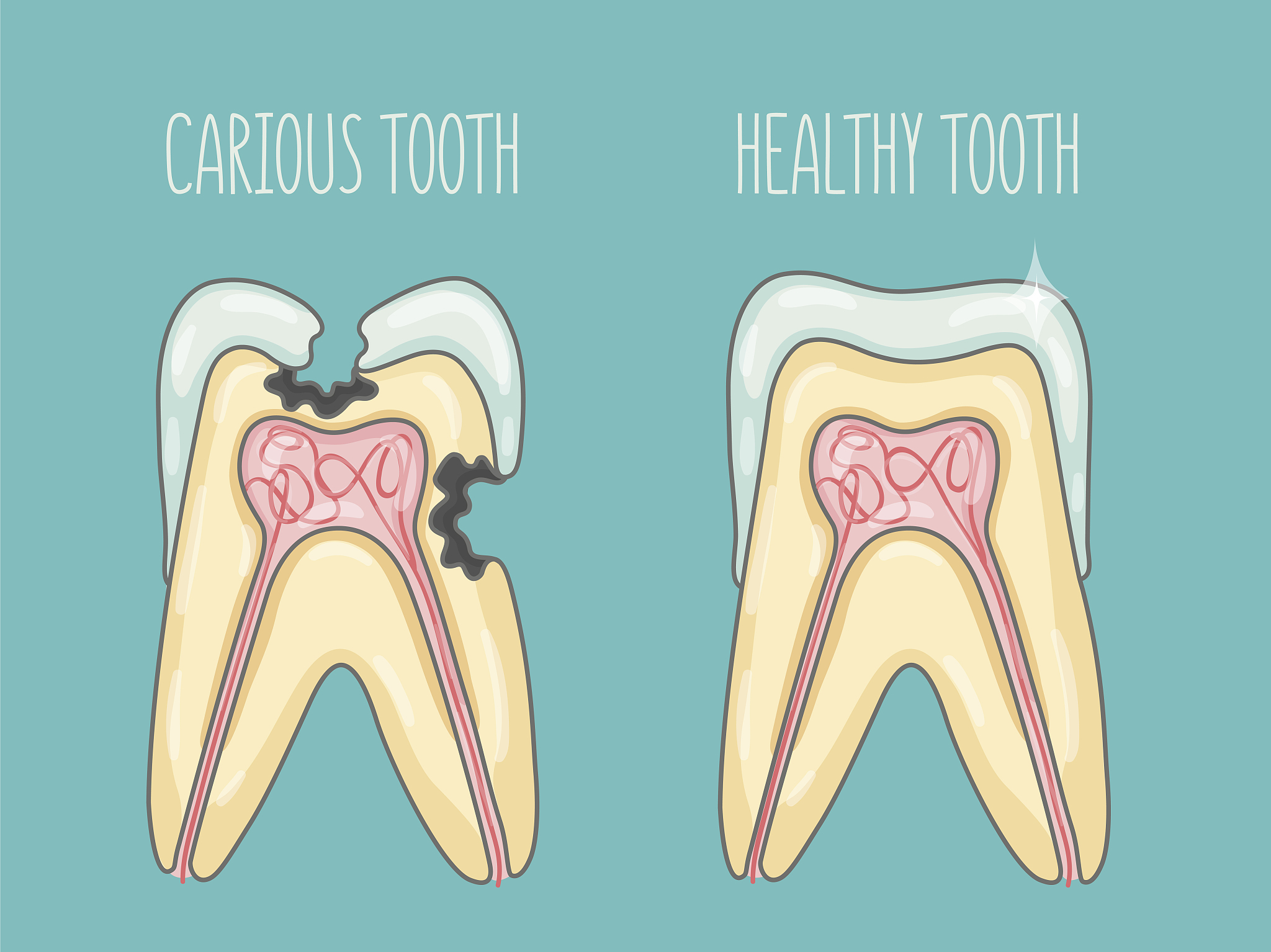吸烟、碳酸饮料、抑郁症会导致龋齿吗？