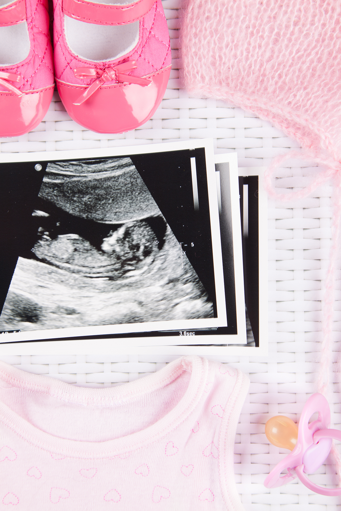 ultrasound photo & baby girl clothing