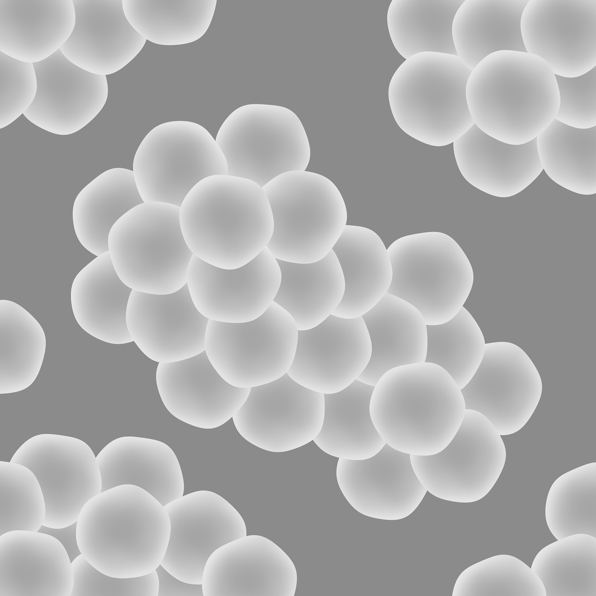 急性肾小球肾炎的病因、临床表现、诊断、治疗