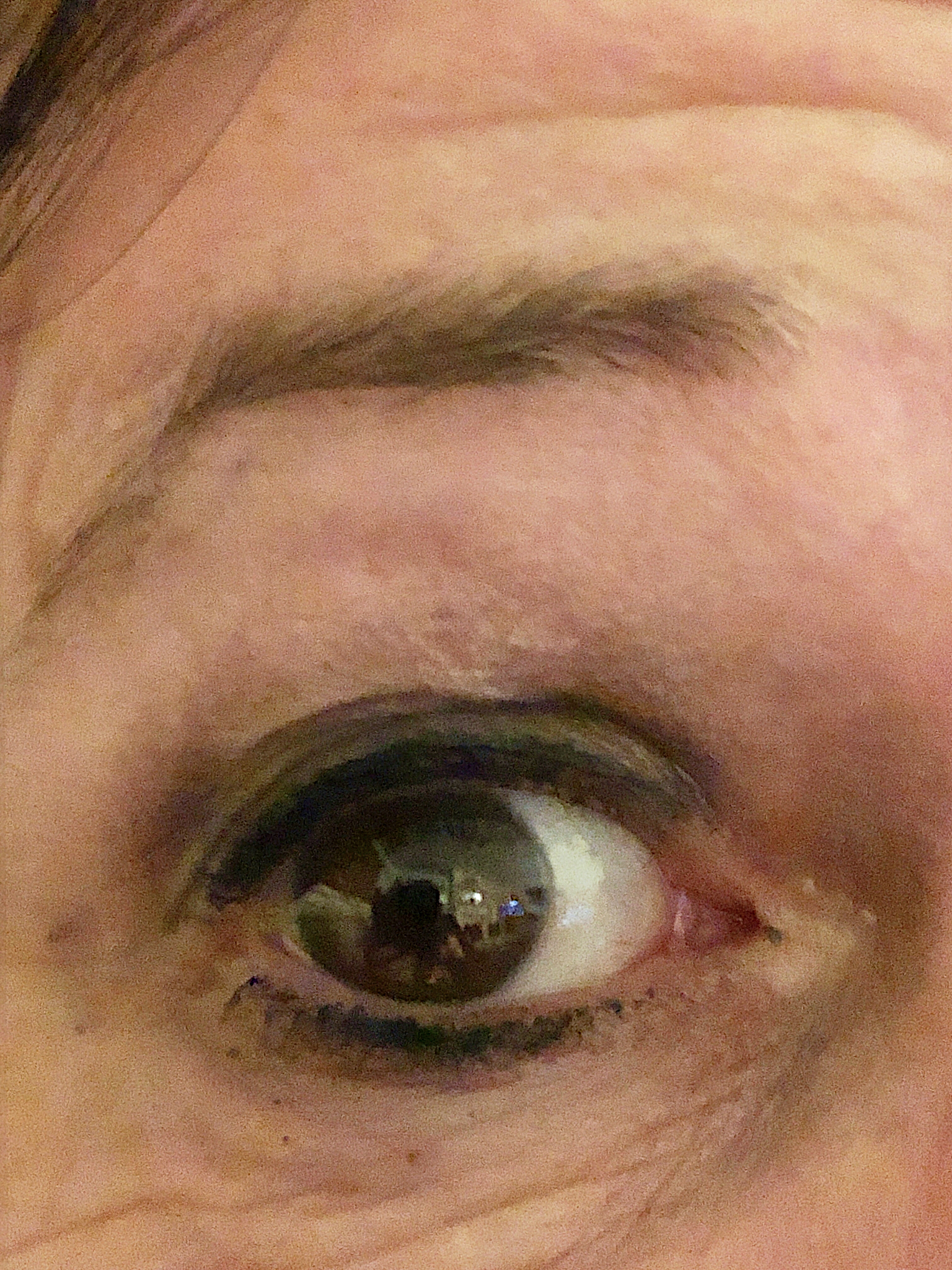 眼皮突然肿个包