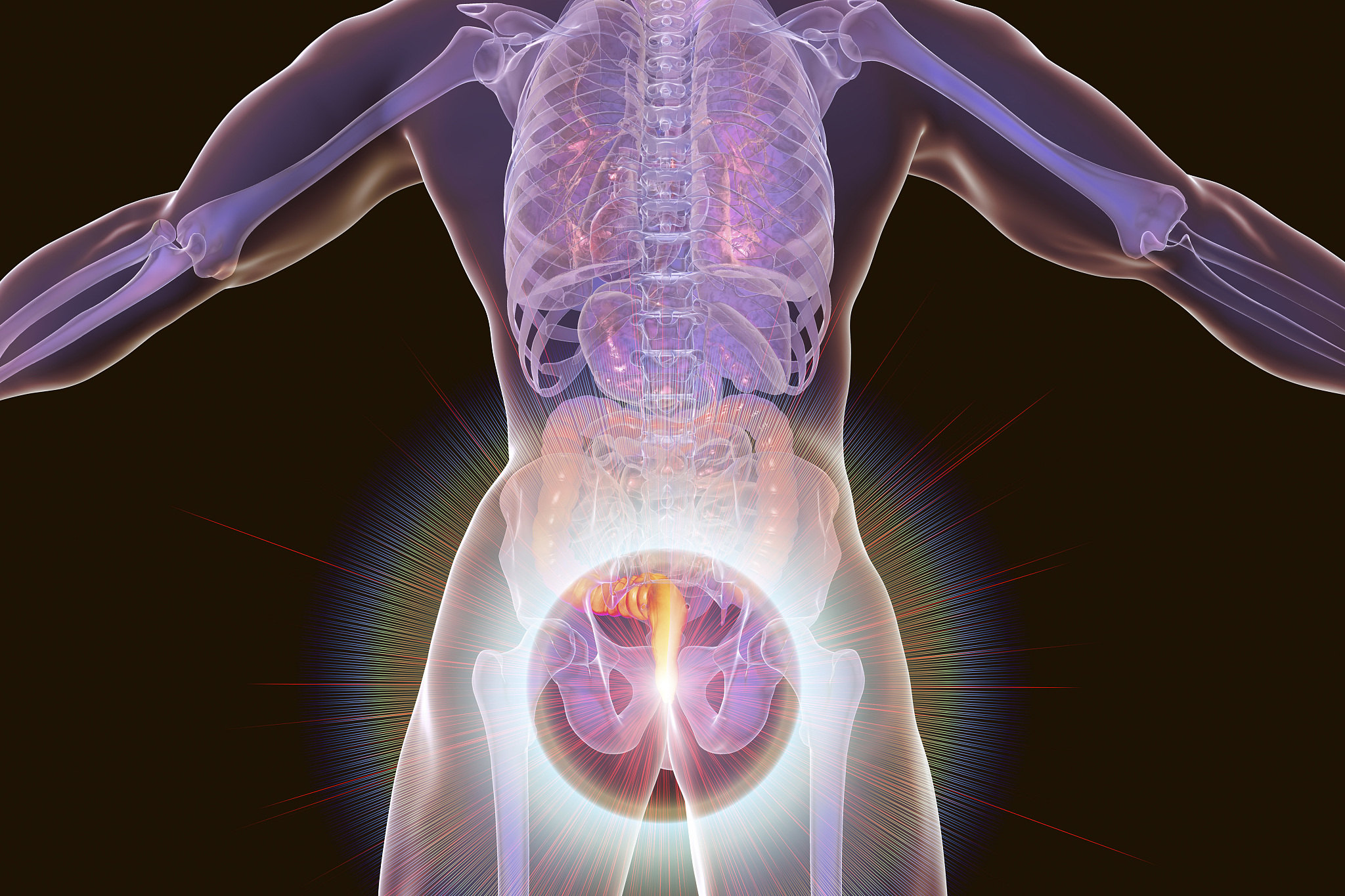 haemorrhoids, illustration