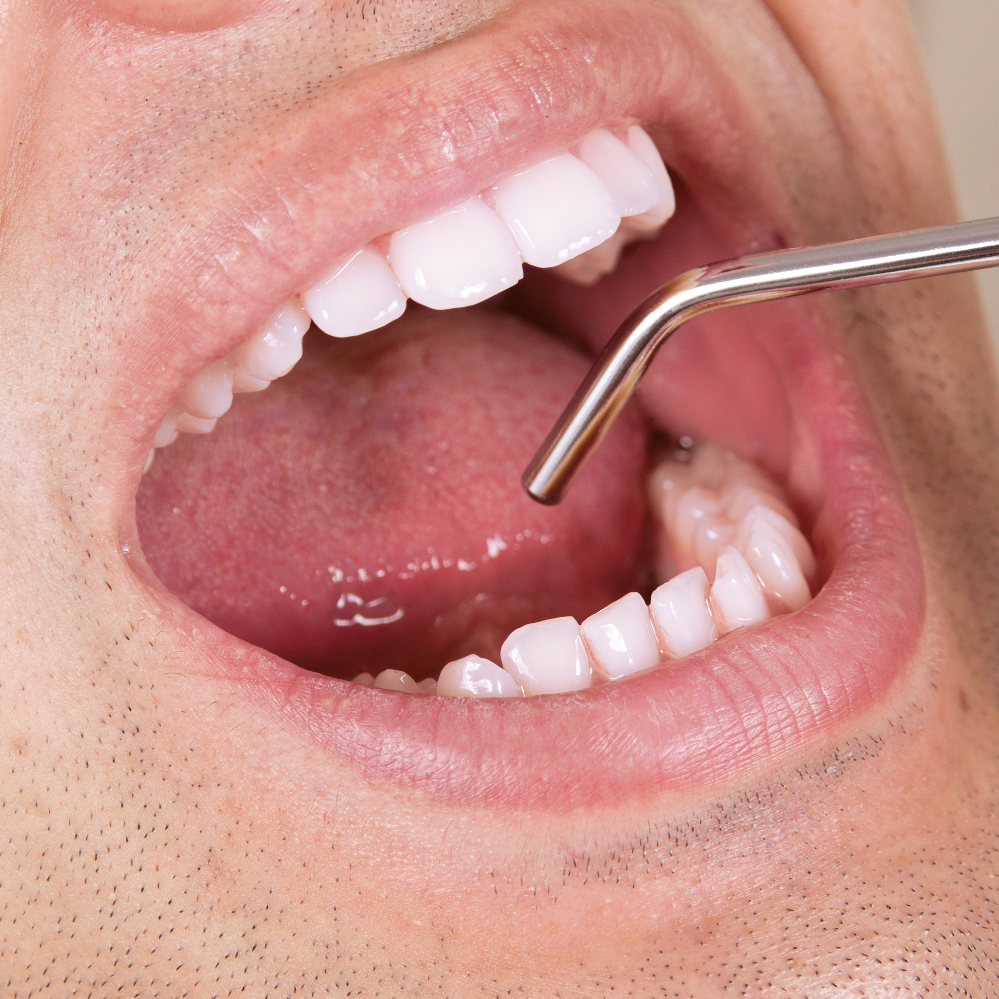 重庆卫校有口腔医学专业吗？| 重庆口腔医学专业院校推荐