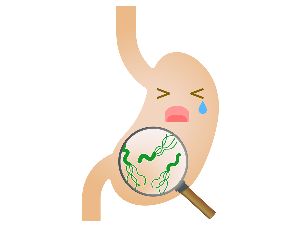 口臭、腹胀、反酸？警惕幽门螺杆菌感染！这四种人更要检查
