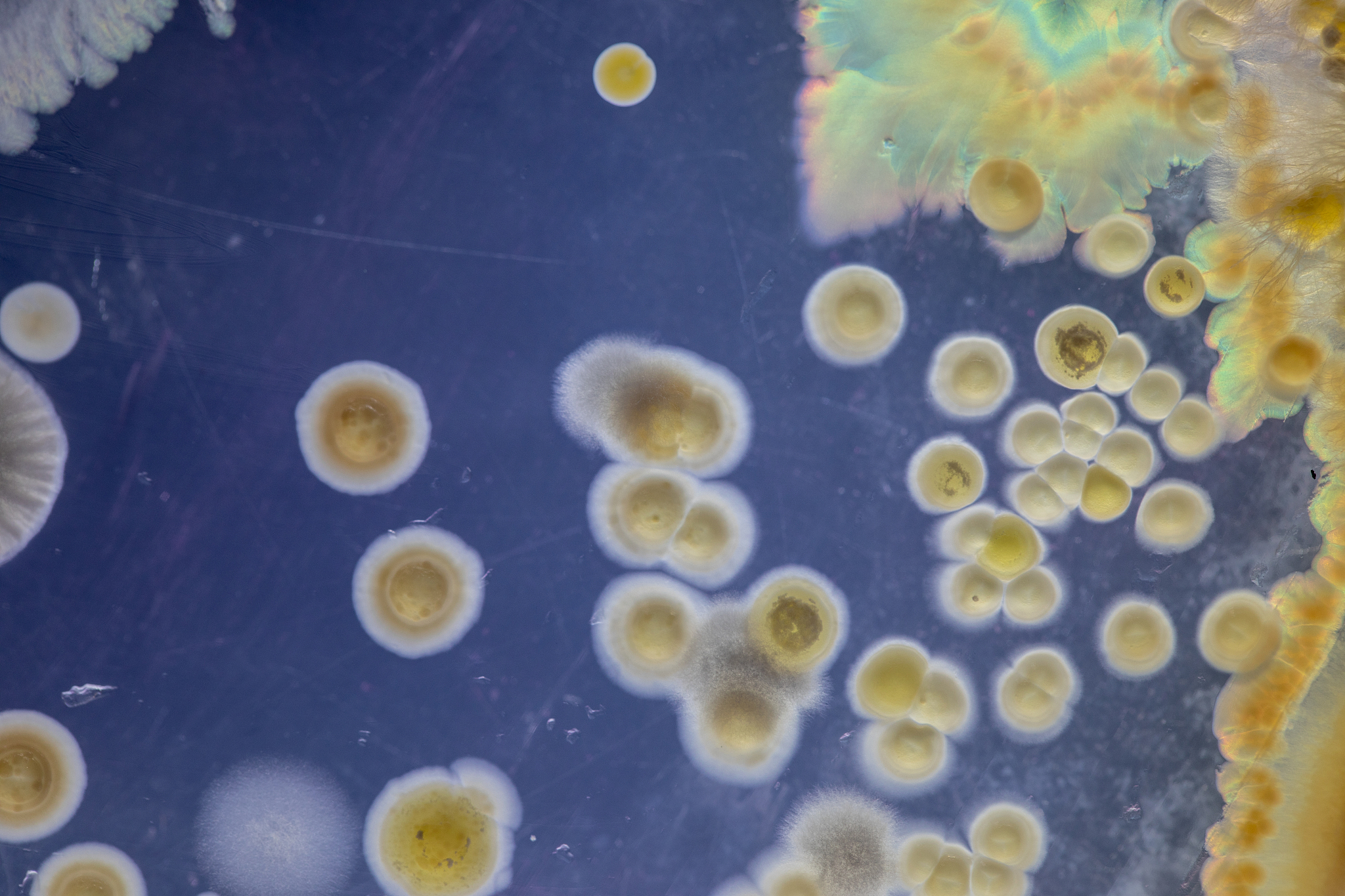 针对一下霉菌写一份观察他们显微镜结过后得出共同结论以及和放线菌的共同结论 1、青霉 2、曲霉 3、黑根霉 4、匍枝根霉5、面包霉 6、有隔菌丝 7、无隔菌丝